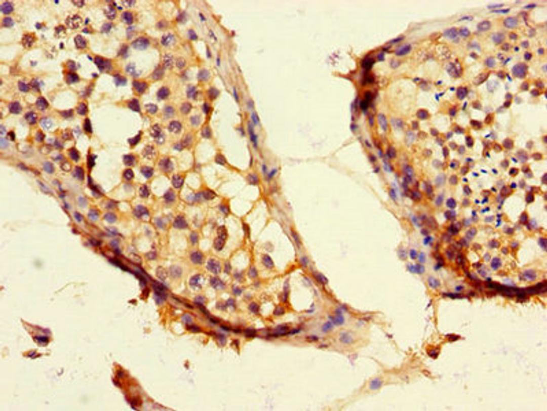 Immunohistochemistry of paraffin-embedded human testis tissue using CSB-PA851560LA01HU at dilution of 1:100