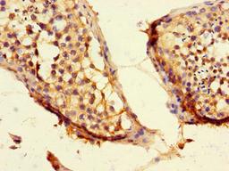 Immunohistochemistry of paraffin-embedded human testis tissue using CSB-PA851560LA01HU at dilution of 1:100