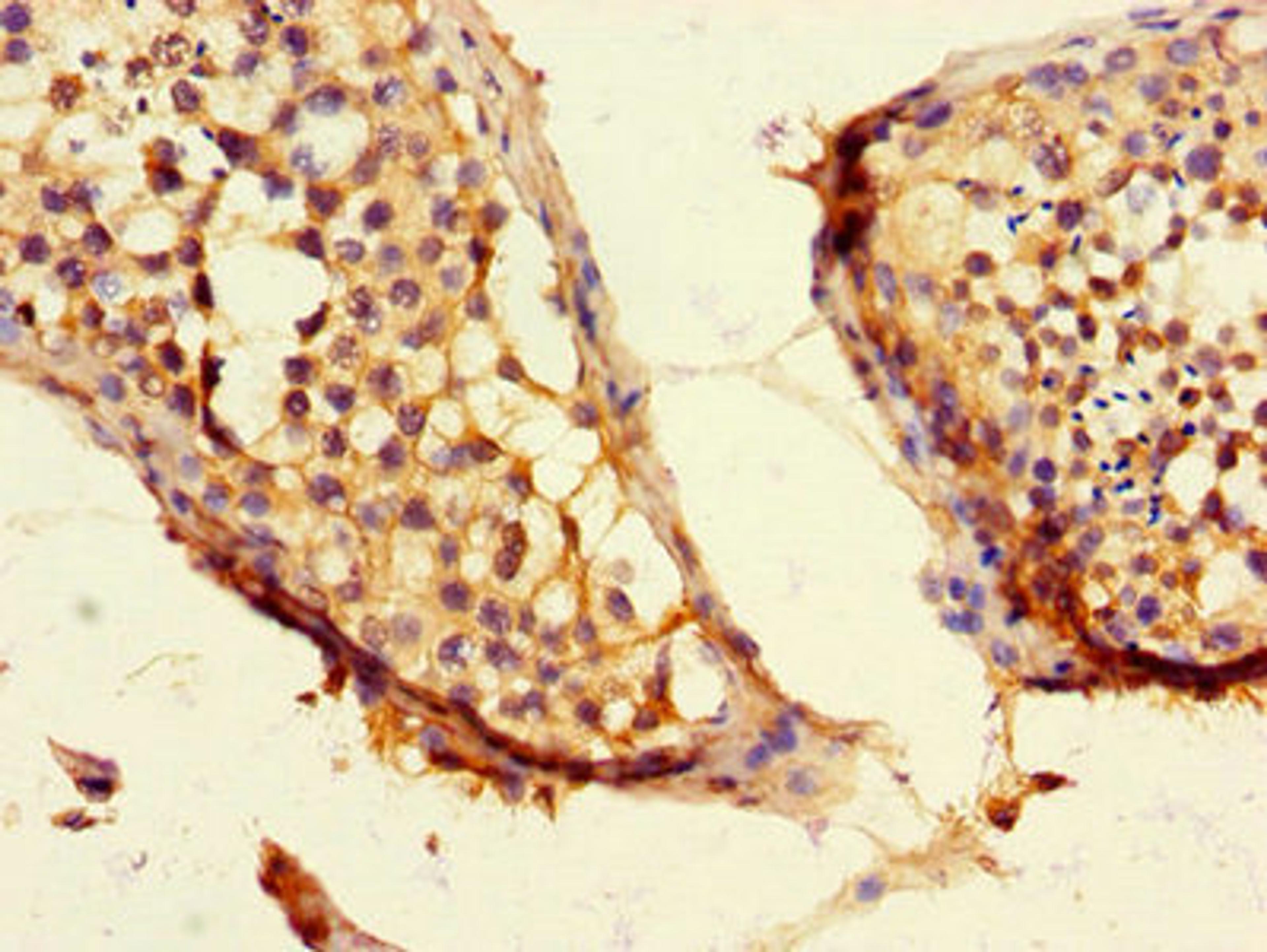 Immunohistochemistry of paraffin-embedded human testis tissue using CSB-PA851560LA01HU at dilution of 1:100
