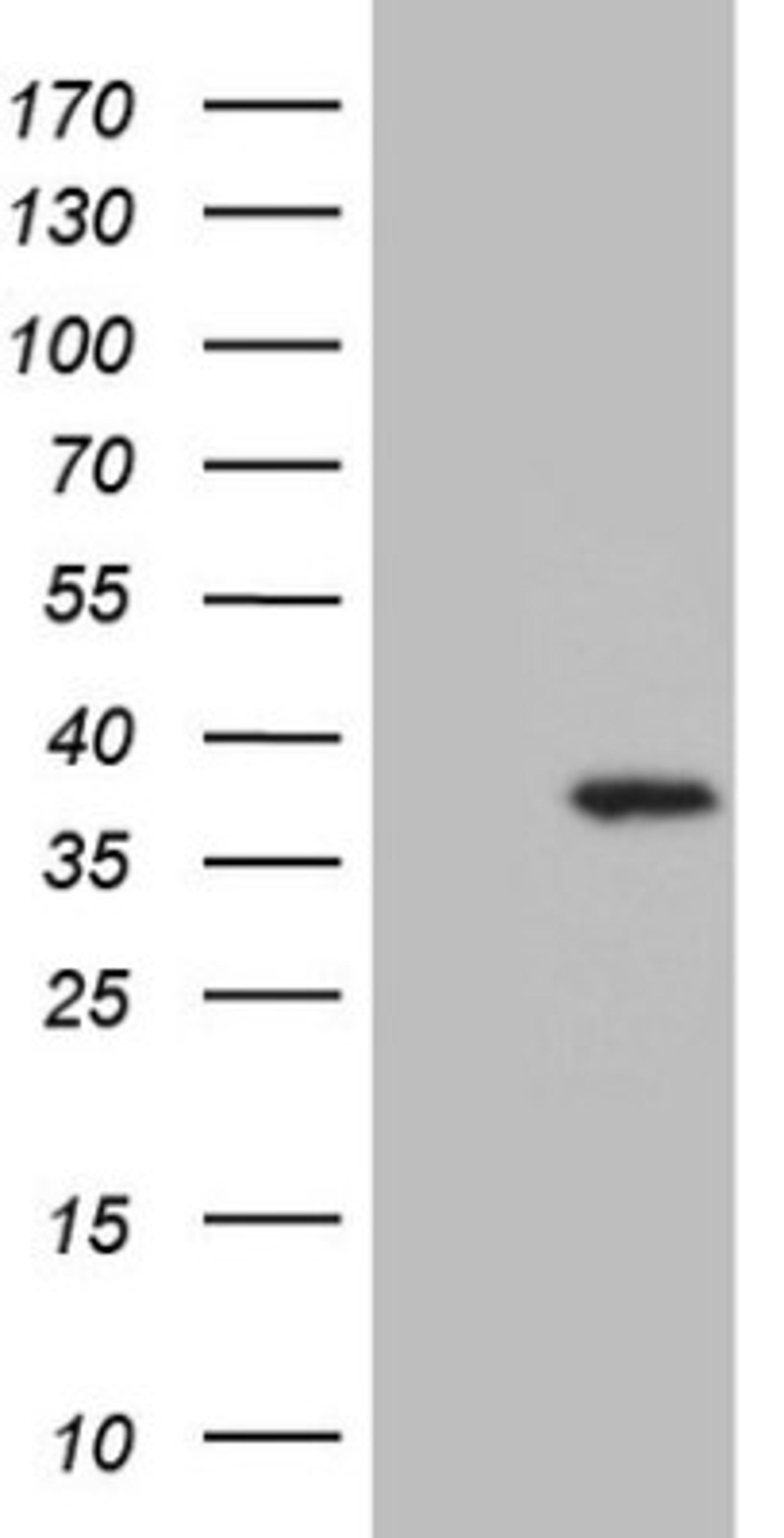 Western Blot: UTP11L Antibody (5F3) [NBP2-46318] - Analysis of HEK293T cells were transfected with the pCMV6-ENTRY control (Left lane) or pCMV6-ENTRY UTP11L.