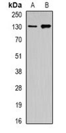 Western blot analysis of Raji (Lane1), Hela (Lane2) whole cell lysates using GOLGA2 antibody