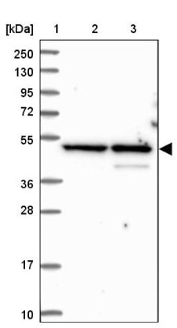 Western Blot: BLMH Antibody [NBP1-88640] - Lane 1: Marker [kDa] 250, 130, 95, 72, 55, 36, 28, 17, 10<br/>Lane 2: Human cell line RT-4<br/>Lane 3: Human cell line U-251MG sp