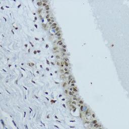 Immunohistochemistry  - NR1I3  antibody (A17066)