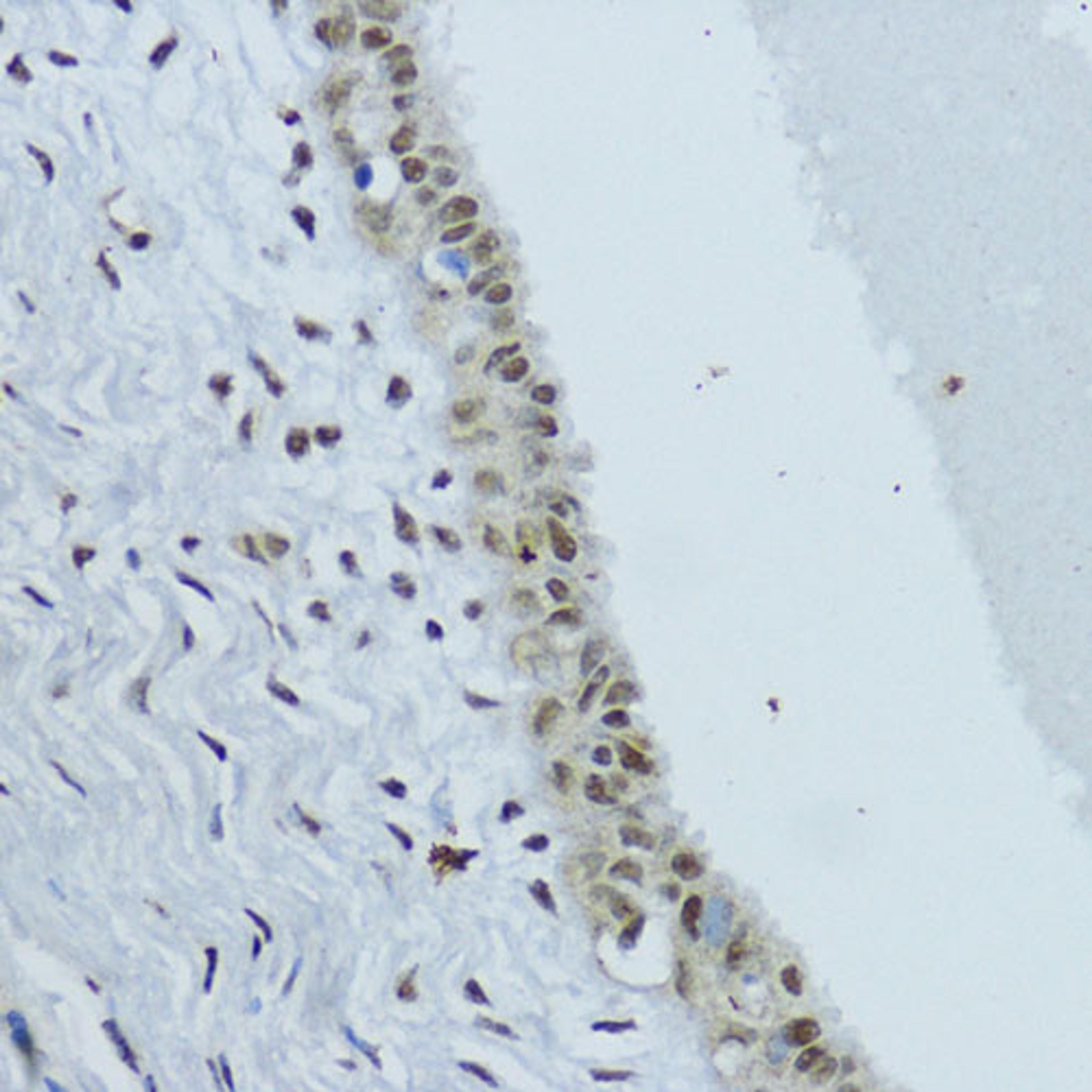 Immunohistochemistry  - NR1I3  antibody (A17066)