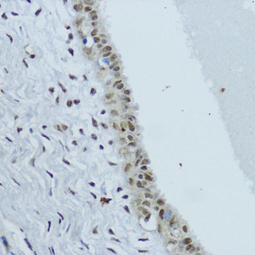 Immunohistochemistry - NR1I3 antibody (A17066)