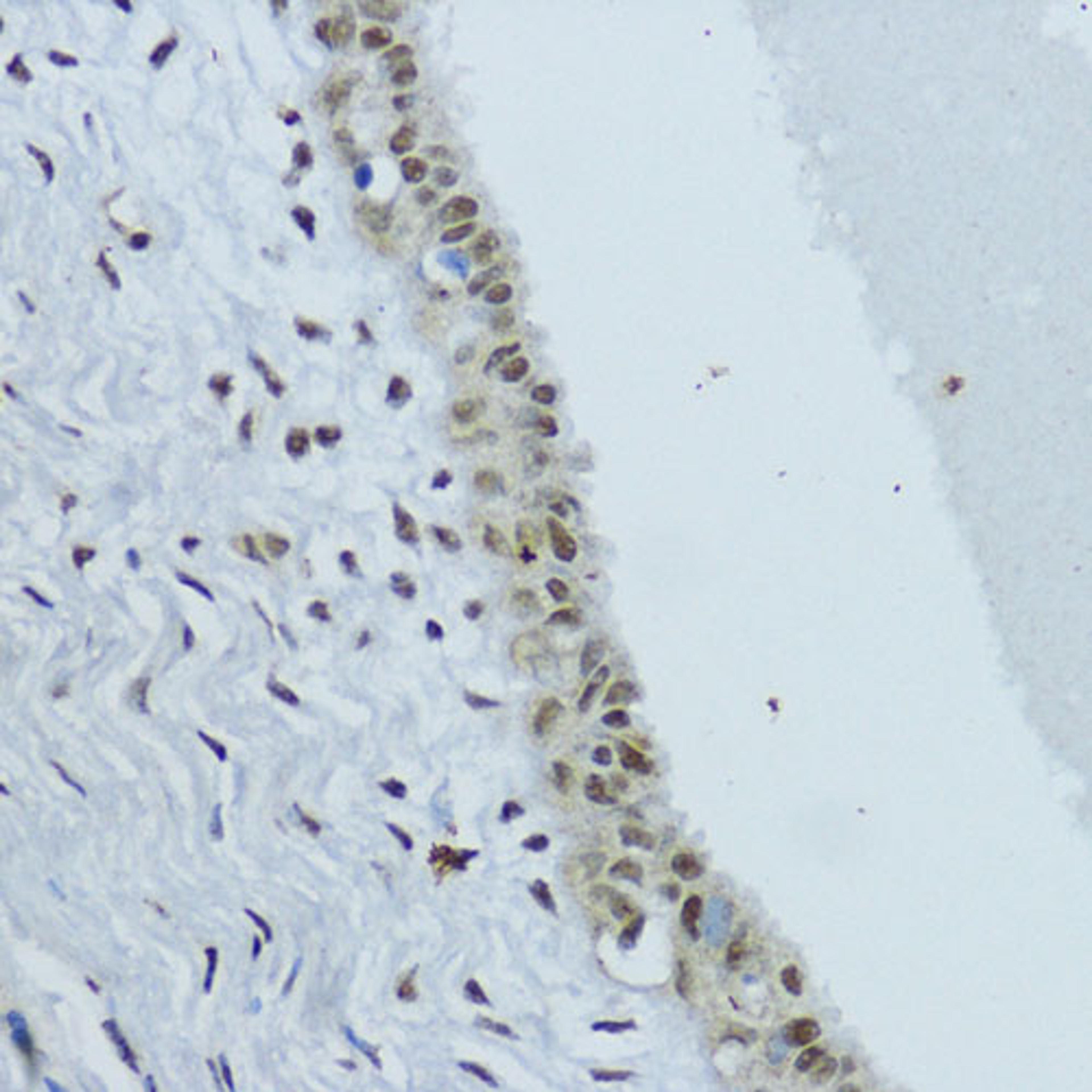 Immunohistochemistry - NR1I3 antibody (A17066)