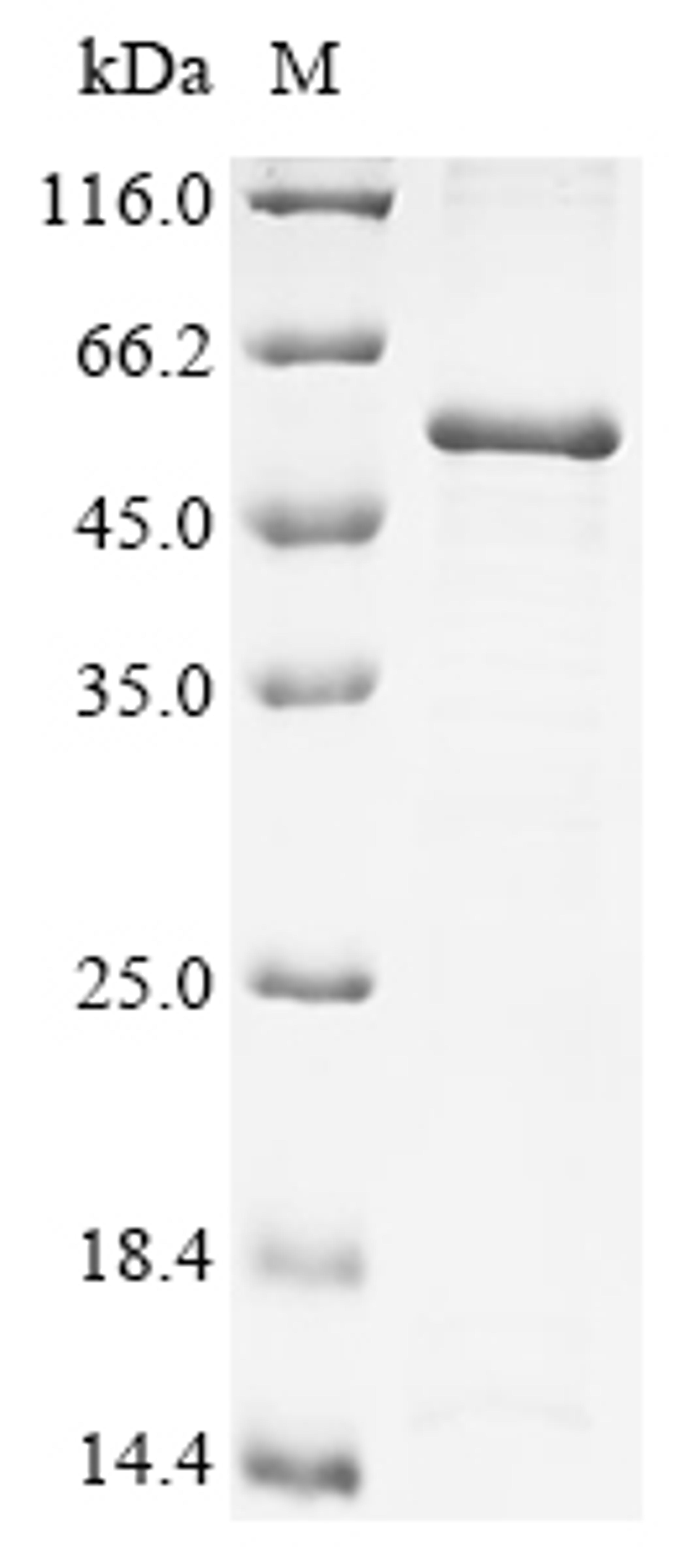 (Tris-Glycine gel) Discontinuous SDS-PAGE (reduced) with 5% enrichment gel and 15% separation gel.