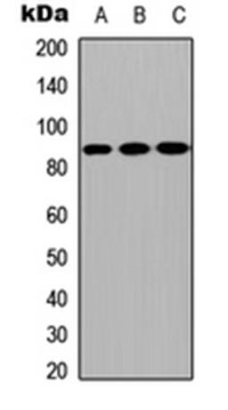 Western blot analysis of MCF7 (Lane1), NS-1 (Lane2), H9C2 (Lane3) whole cell using CPXM2 antibody