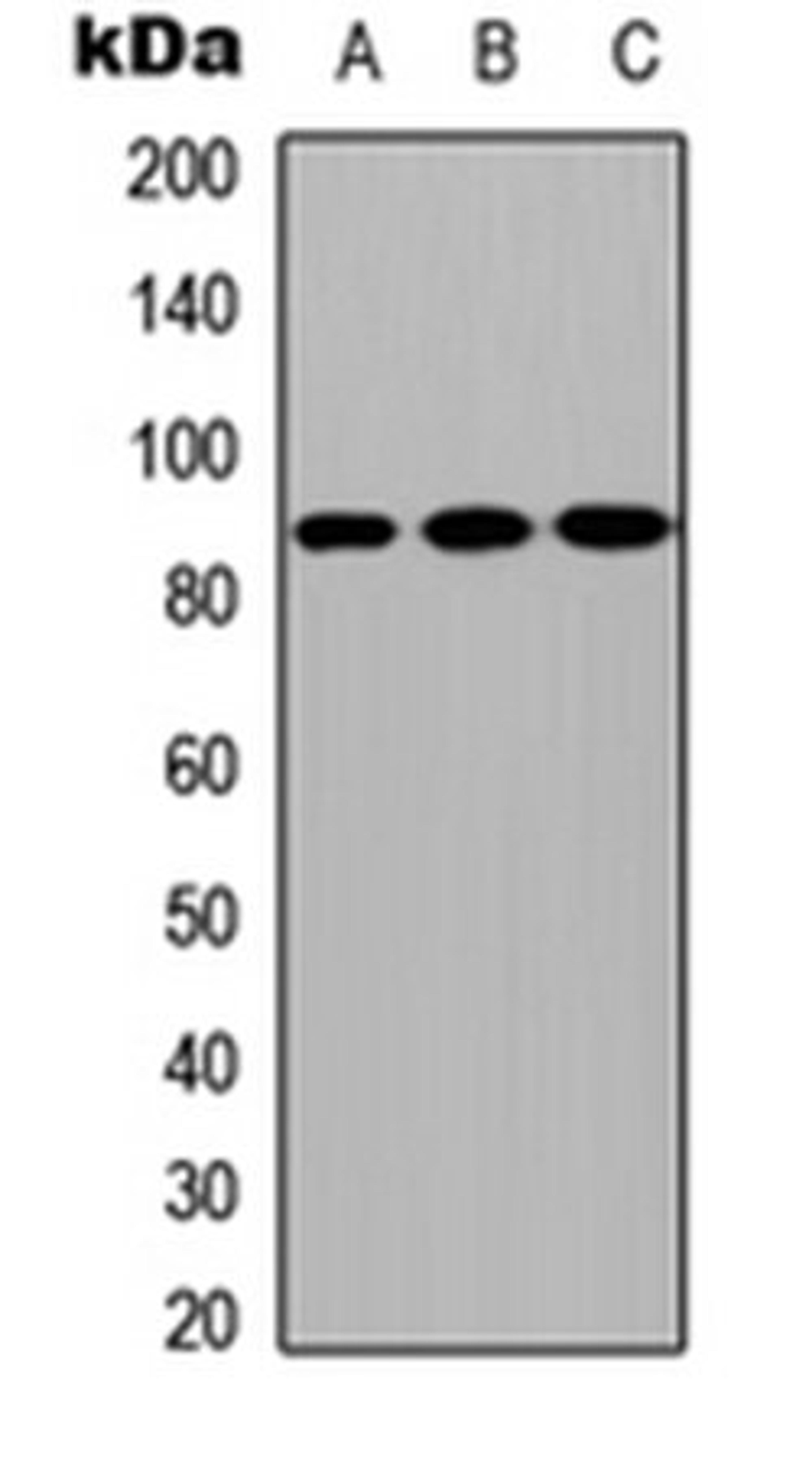 Western blot analysis of MCF7 (Lane1), NS-1 (Lane2), H9C2 (Lane3) whole cell using CPXM2 antibody