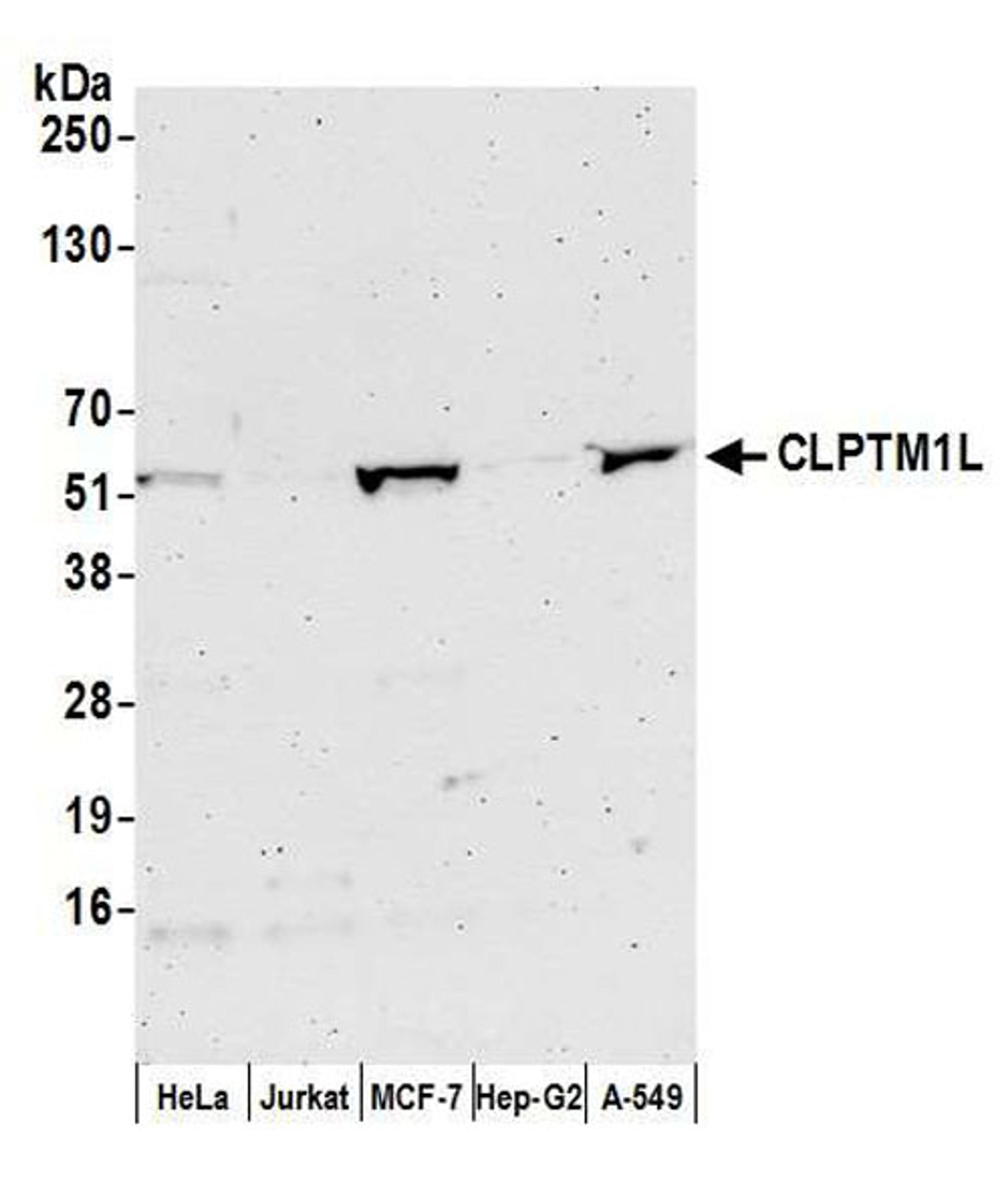 Detection of human CLPTM1L by WB.