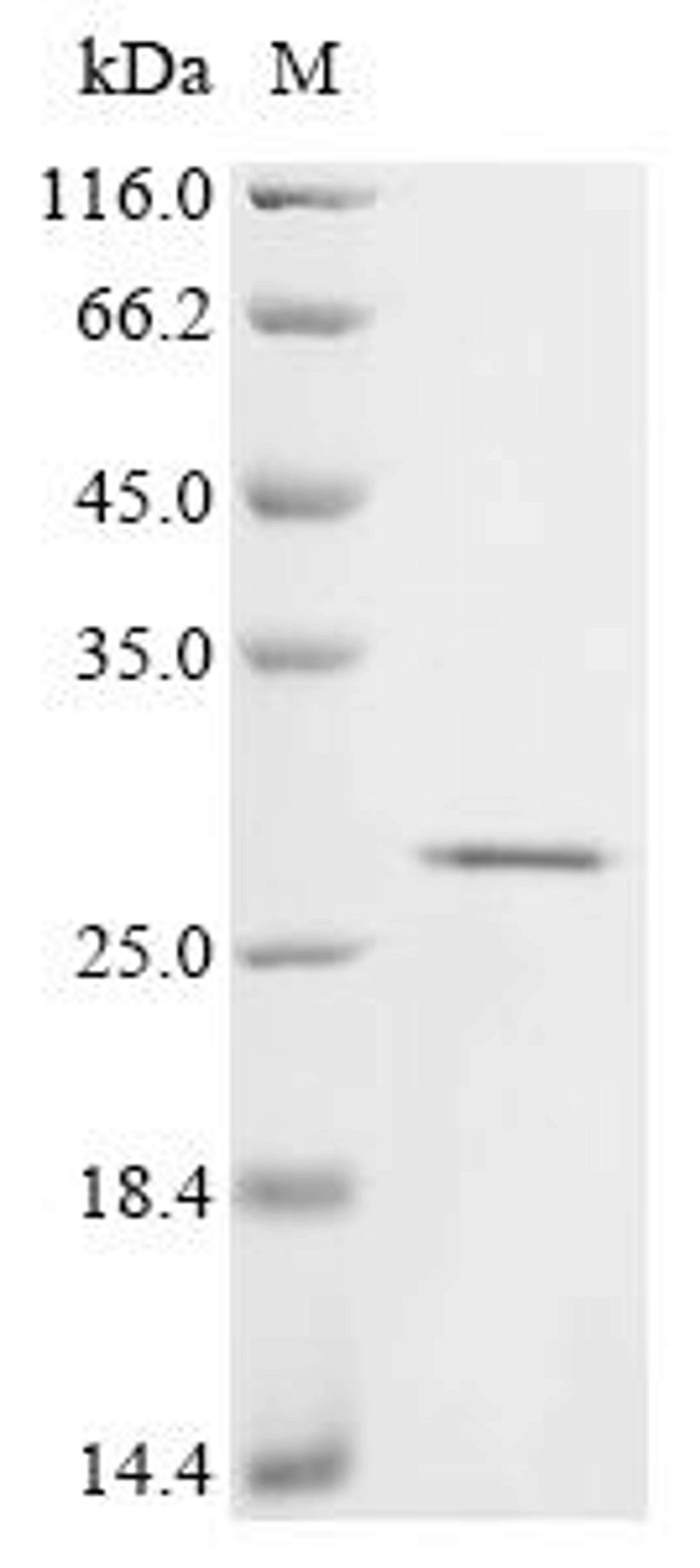 (Tris-Glycine gel) Discontinuous SDS-PAGE (reduced) with 5% enrichment gel and 15% separation gel.