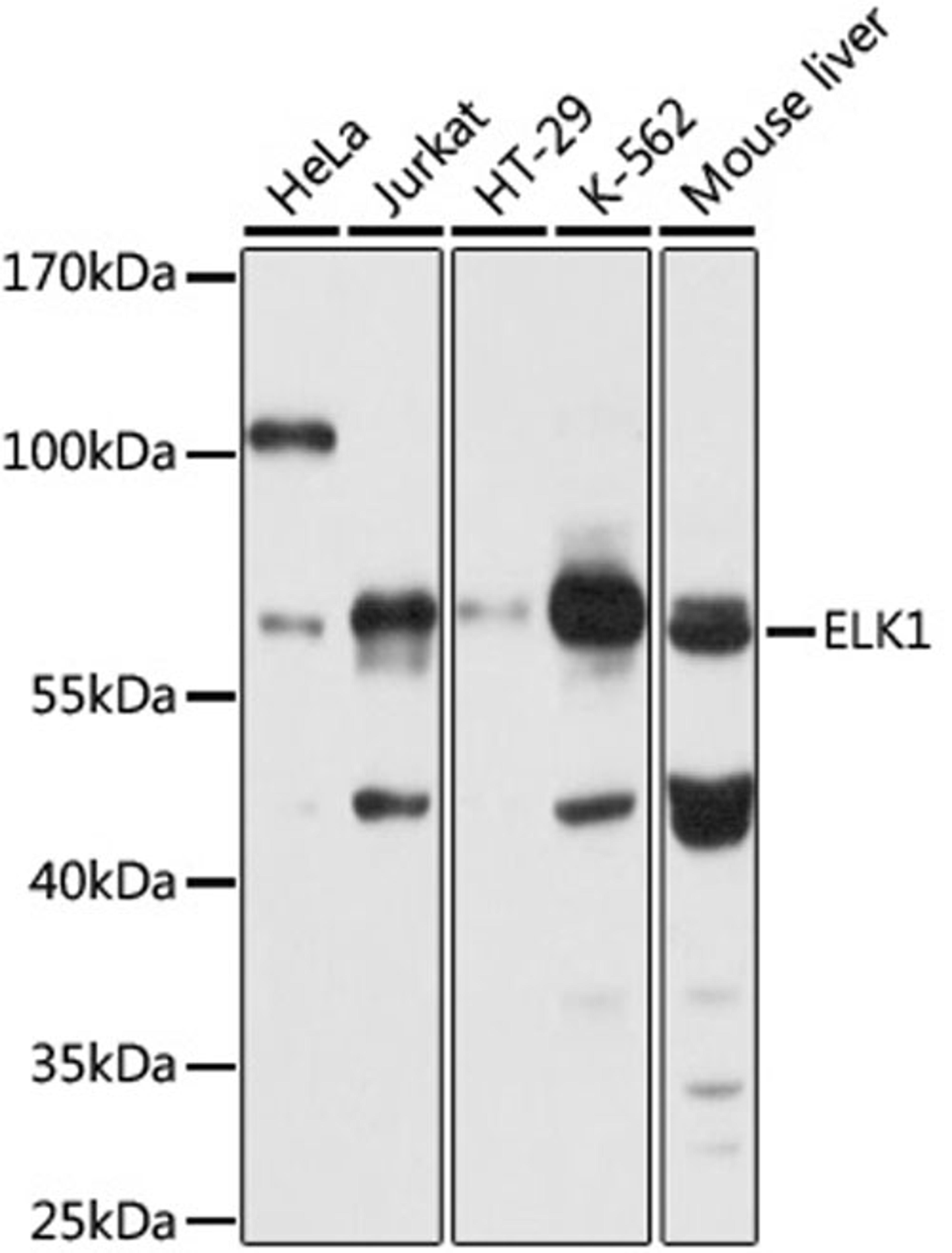 Western blot - ELK1 antibody (A0789)