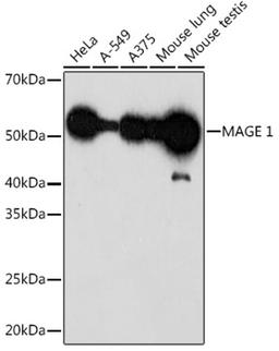 Western blot - MAGE 1 Rabbit mAb (A0723)