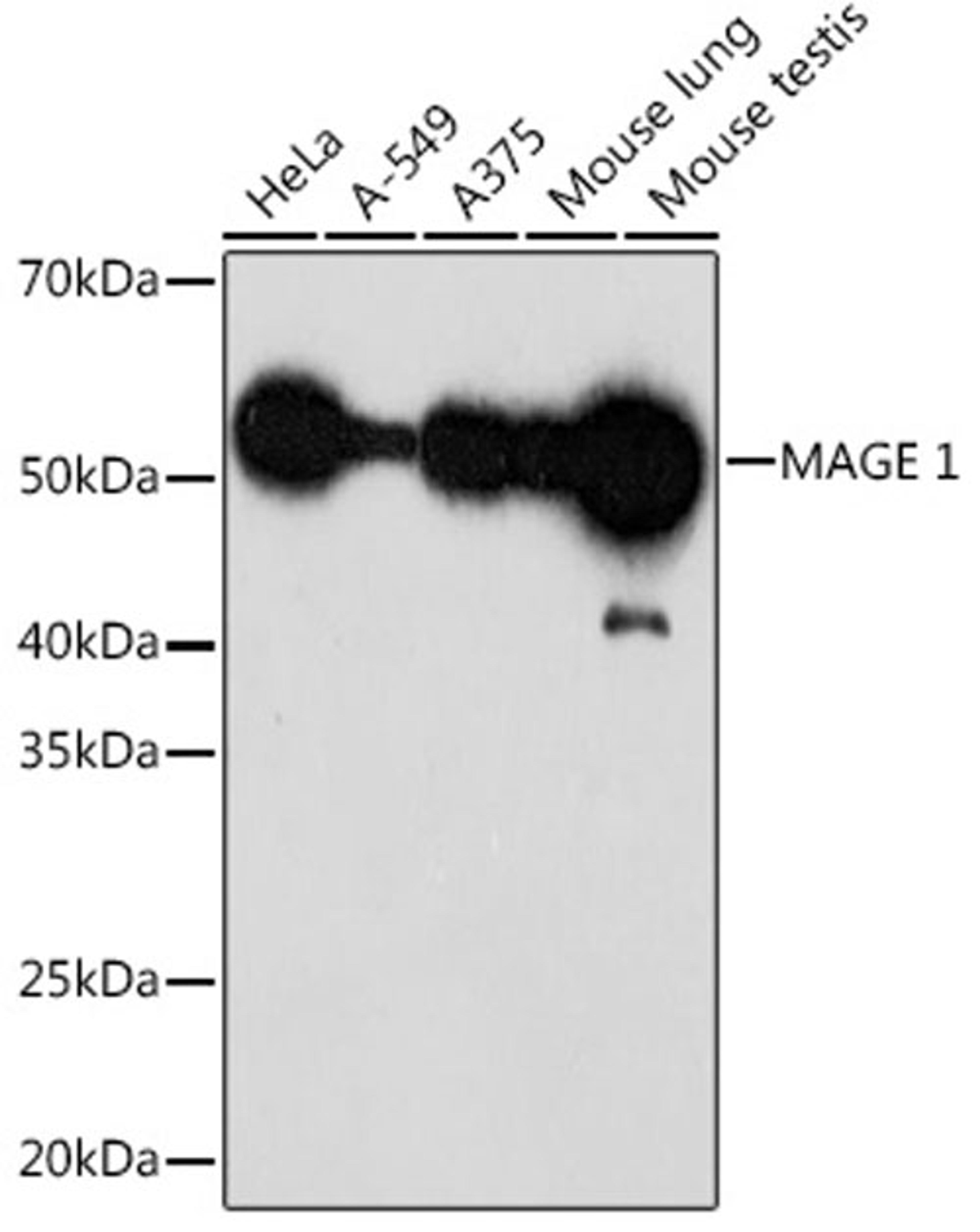 Western blot - MAGE 1 Rabbit mAb (A0723)