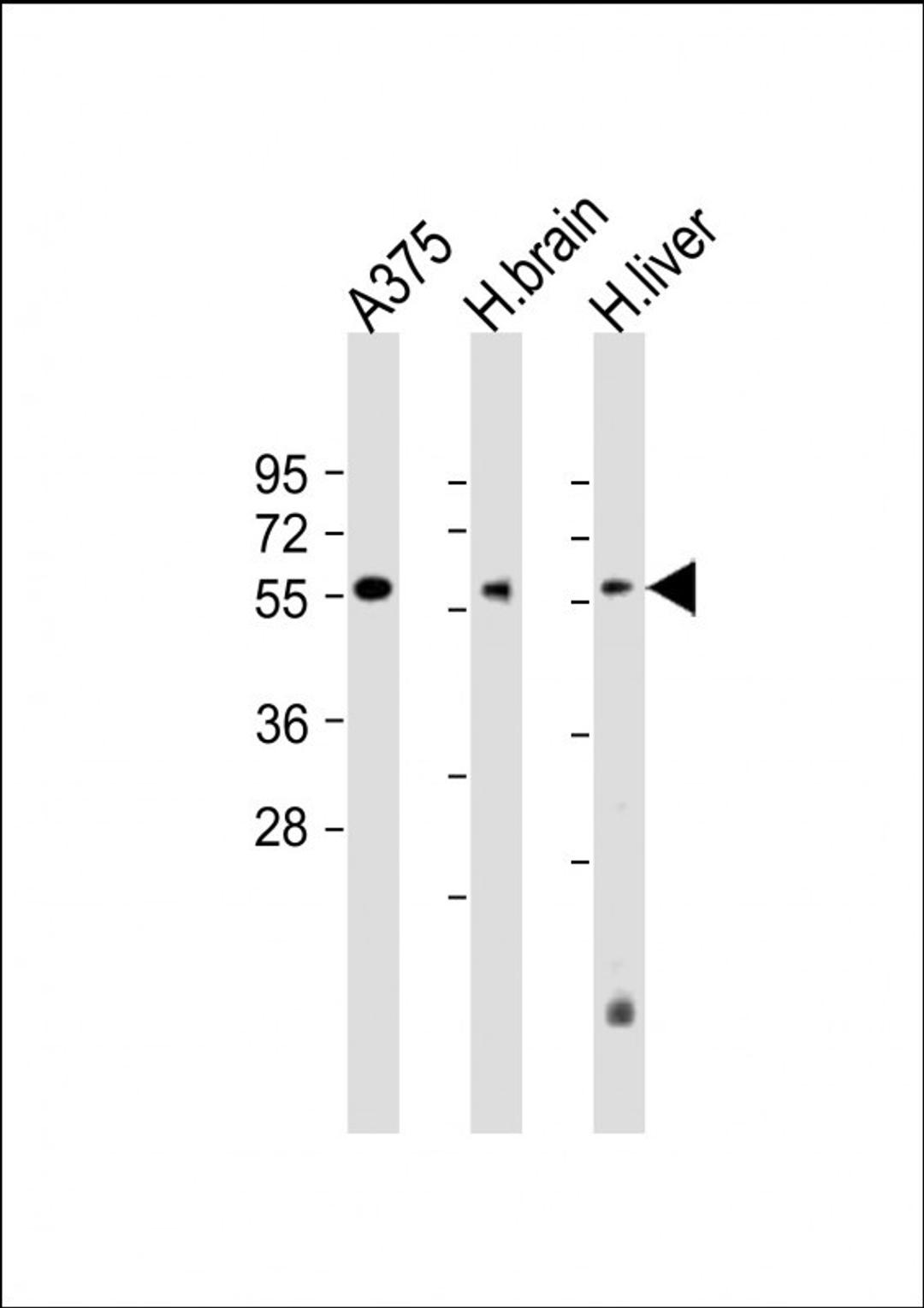 Western Blot at 1:2000 dilution Lane 1: A375 whole cell lysate Lane 2: human brain lysate Lane 3: human liver lysate Lysates/proteins at 20 ug per lane.