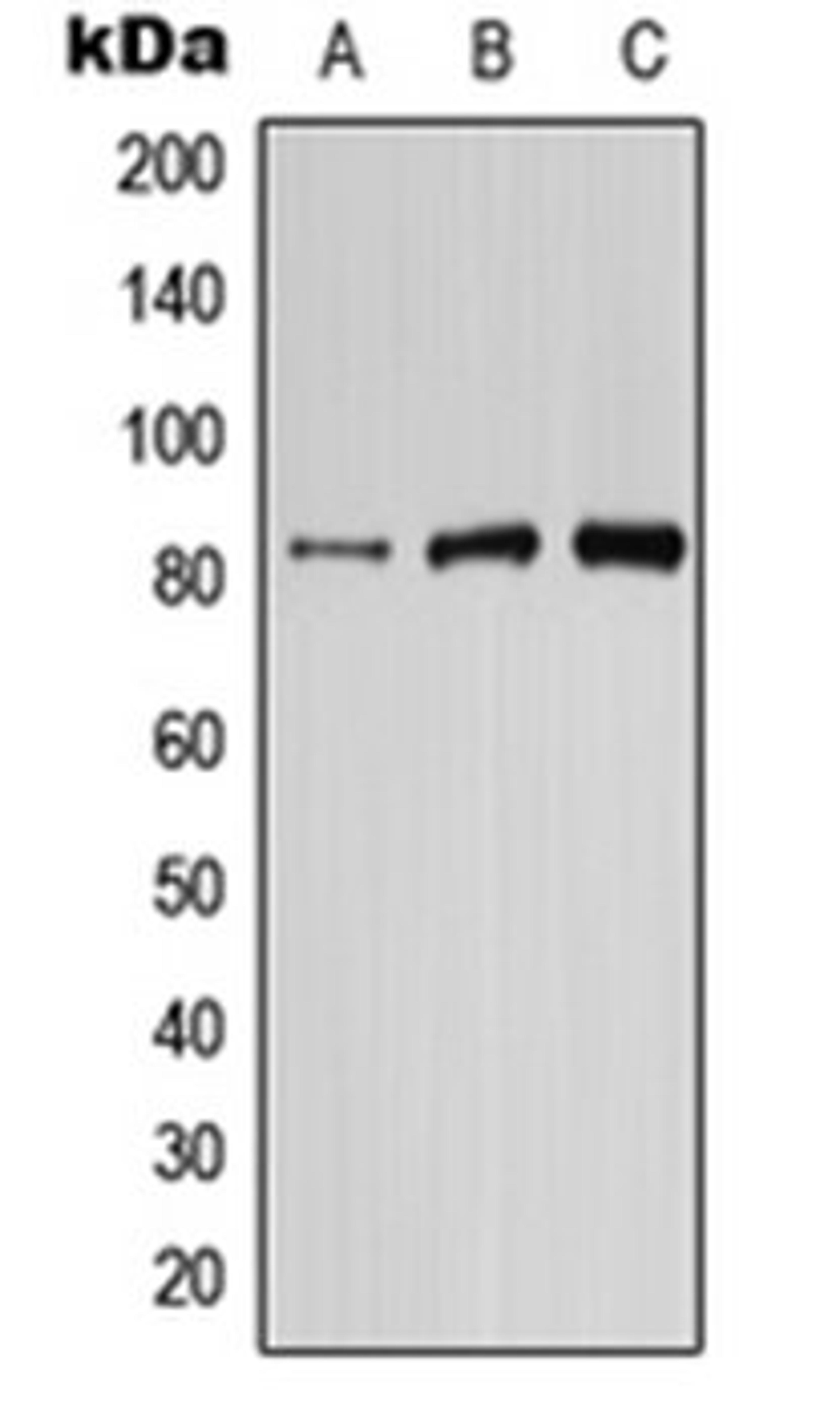 Western blot analysis of HepG2 (Lane 1), mouse brain (Lane 2), rat brain (Lane 3) whole cell lysates using PIK3R6 antibody