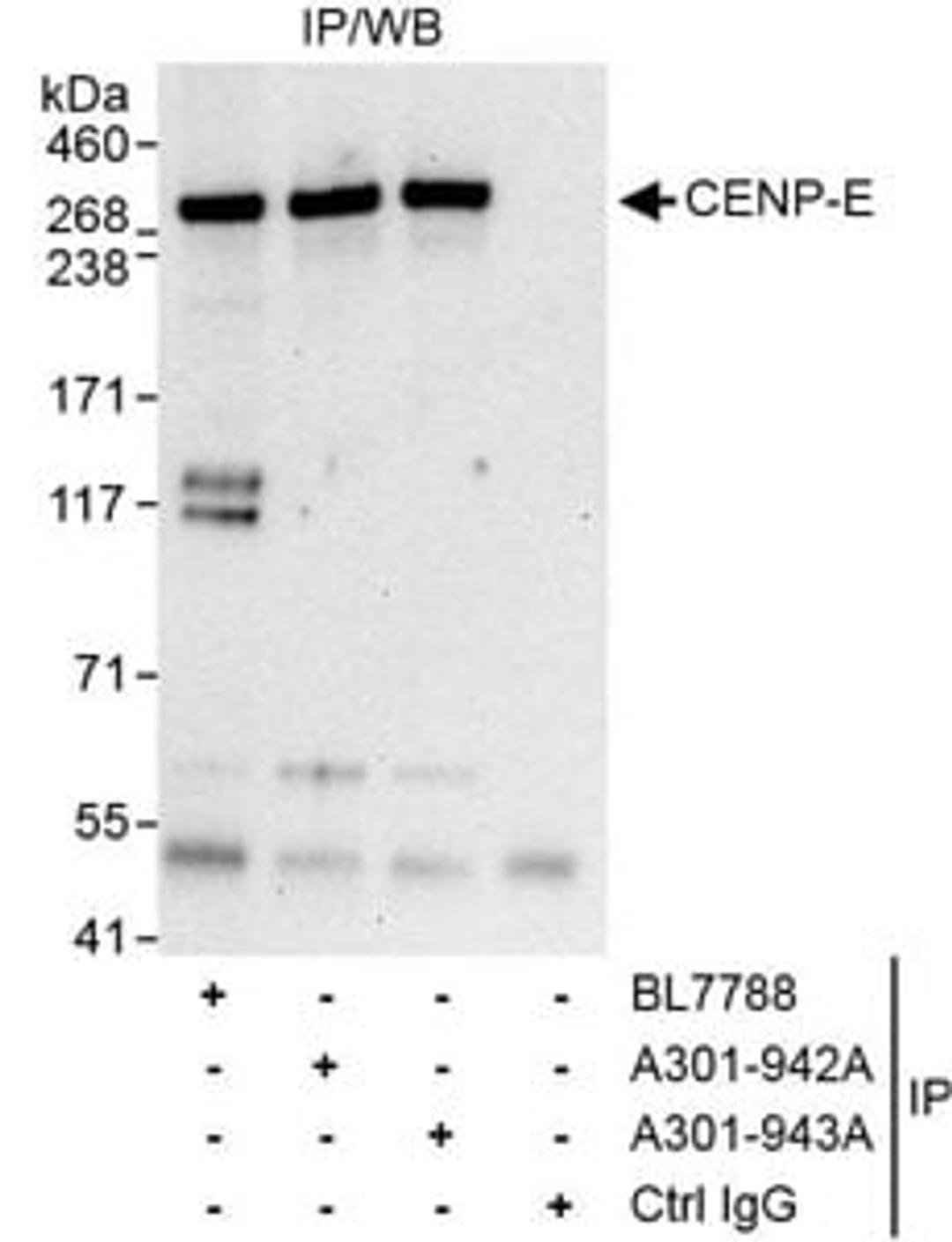 Detection of human CENP-E by western blot of immunoprecipitates.