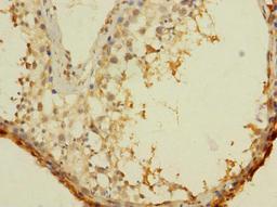 Immunohistochemistry of paraffin-embedded human testis tissue using CSB-PA845159LA01HU at dilution of 1:100