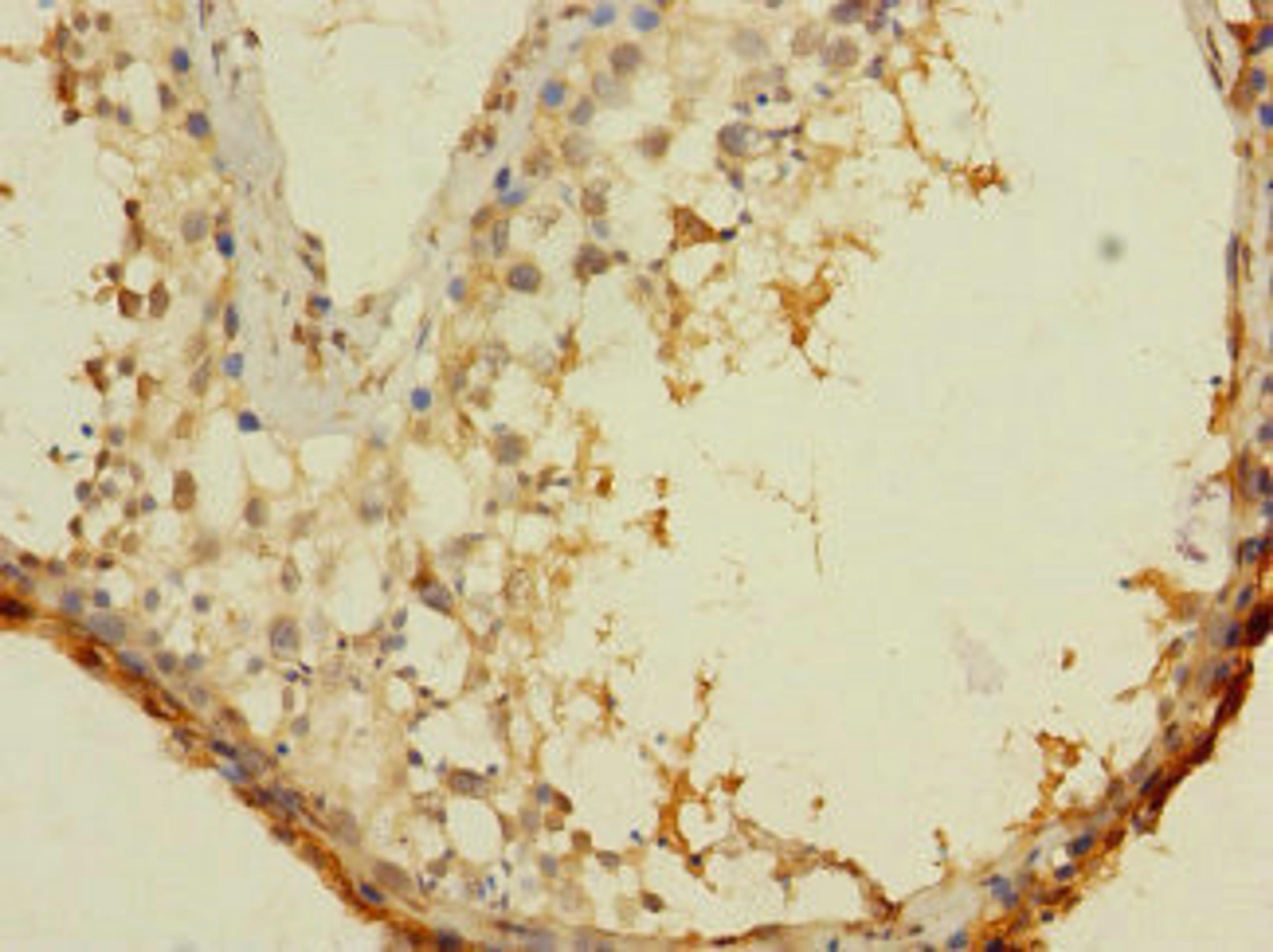 Immunohistochemistry of paraffin-embedded human testis tissue using CSB-PA845159LA01HU at dilution of 1:100