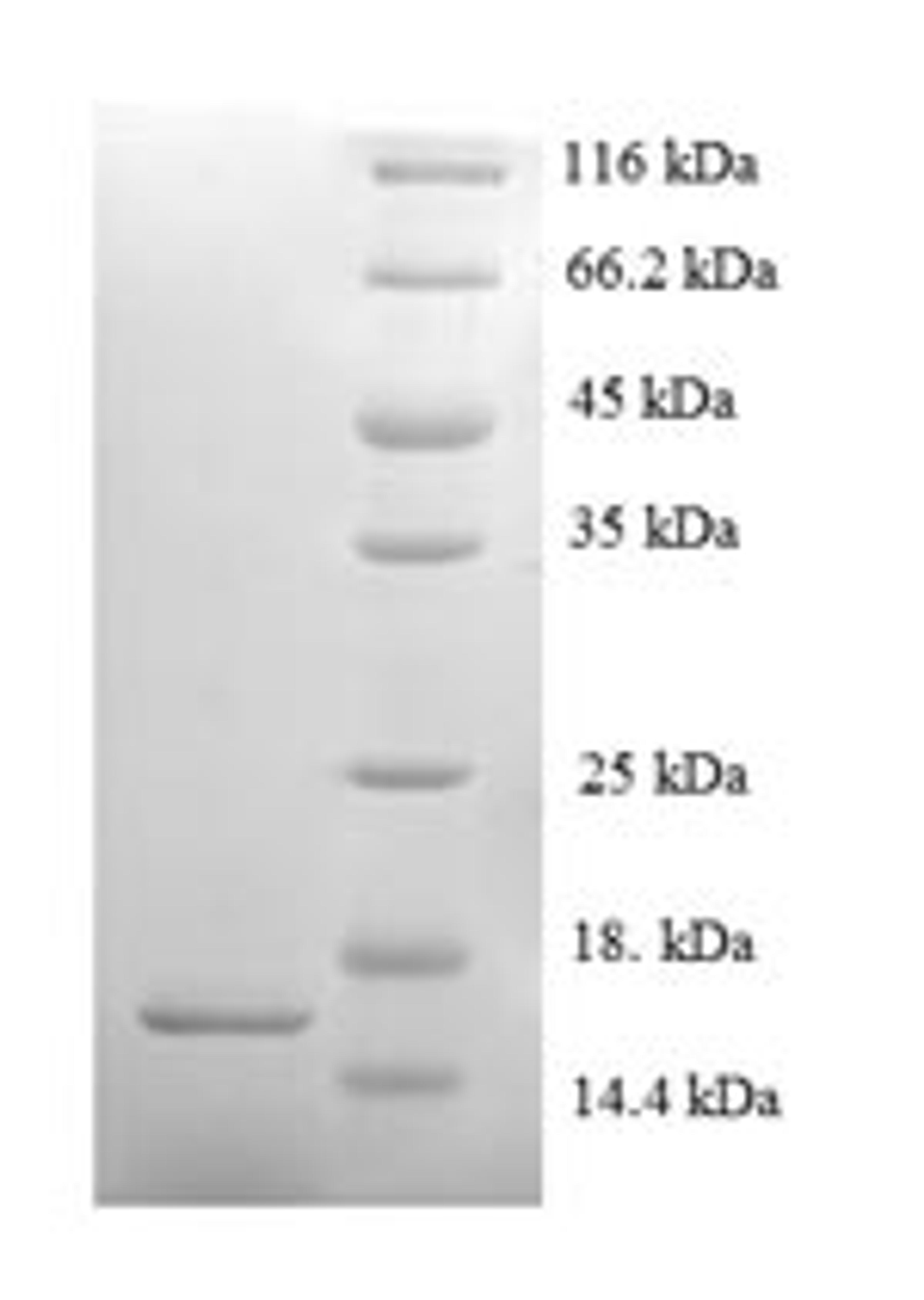 (Tris-Glycine gel) Discontinuous SDS-PAGE (reduced) with 5% enrichment gel and 15% separation gel.