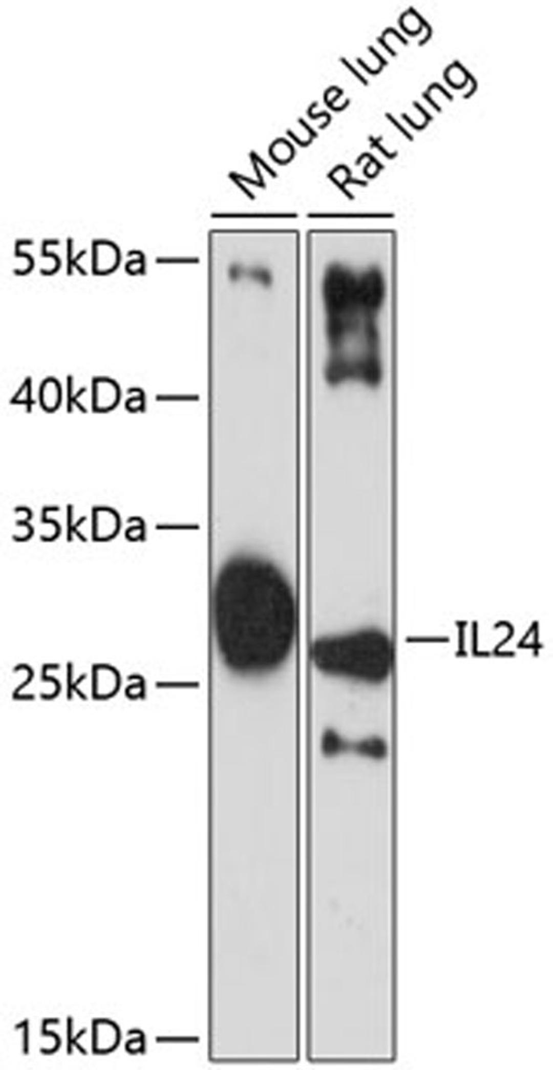 Western blot - IL24 antibody (A1879)