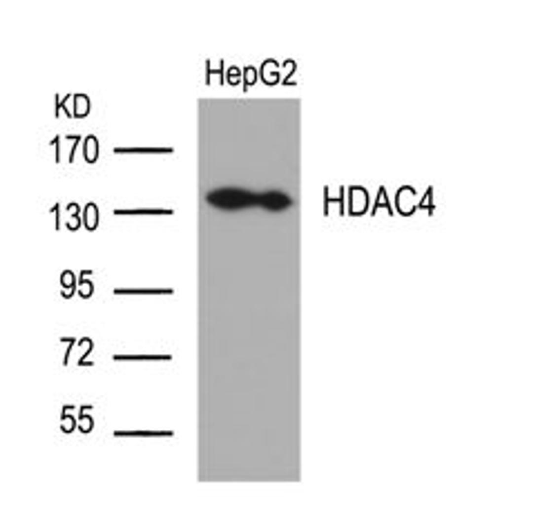 Western blot analysis of lysed extracts from HepG2 cells using HDAC4 (Ab-632).