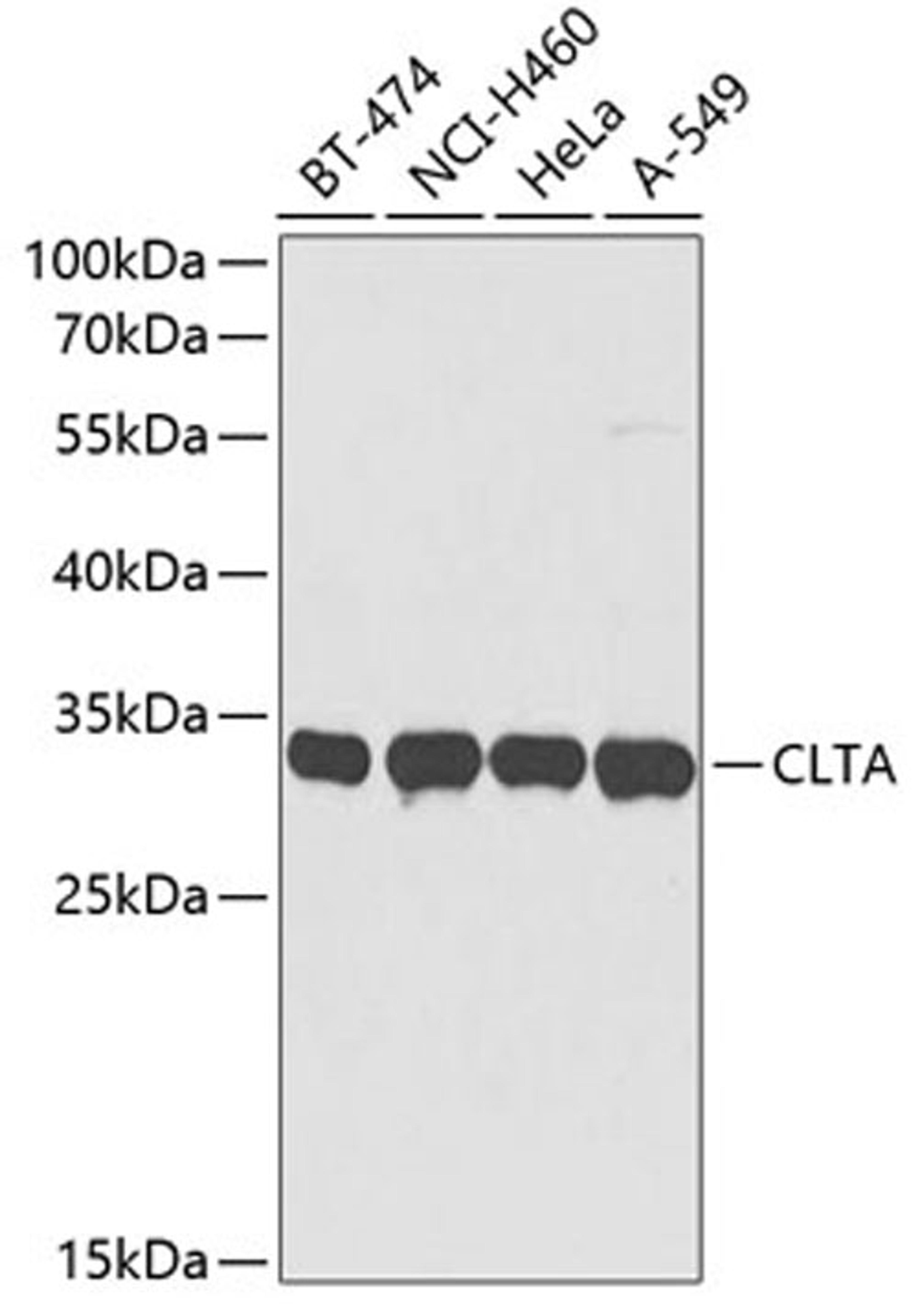 Western blot - CLTA antibody (A3793)