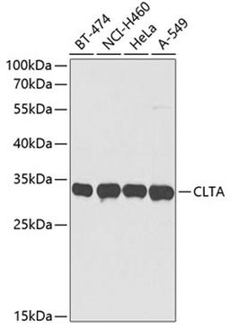 Western blot - CLTA antibody (A3793)