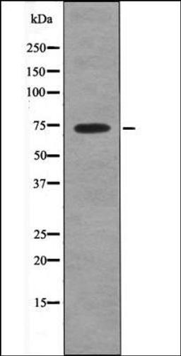 Western blot analysis of Na3VO4 treated HepG2 whole cell lysates using MAP3K2 -Phospho-Ser520- antibody