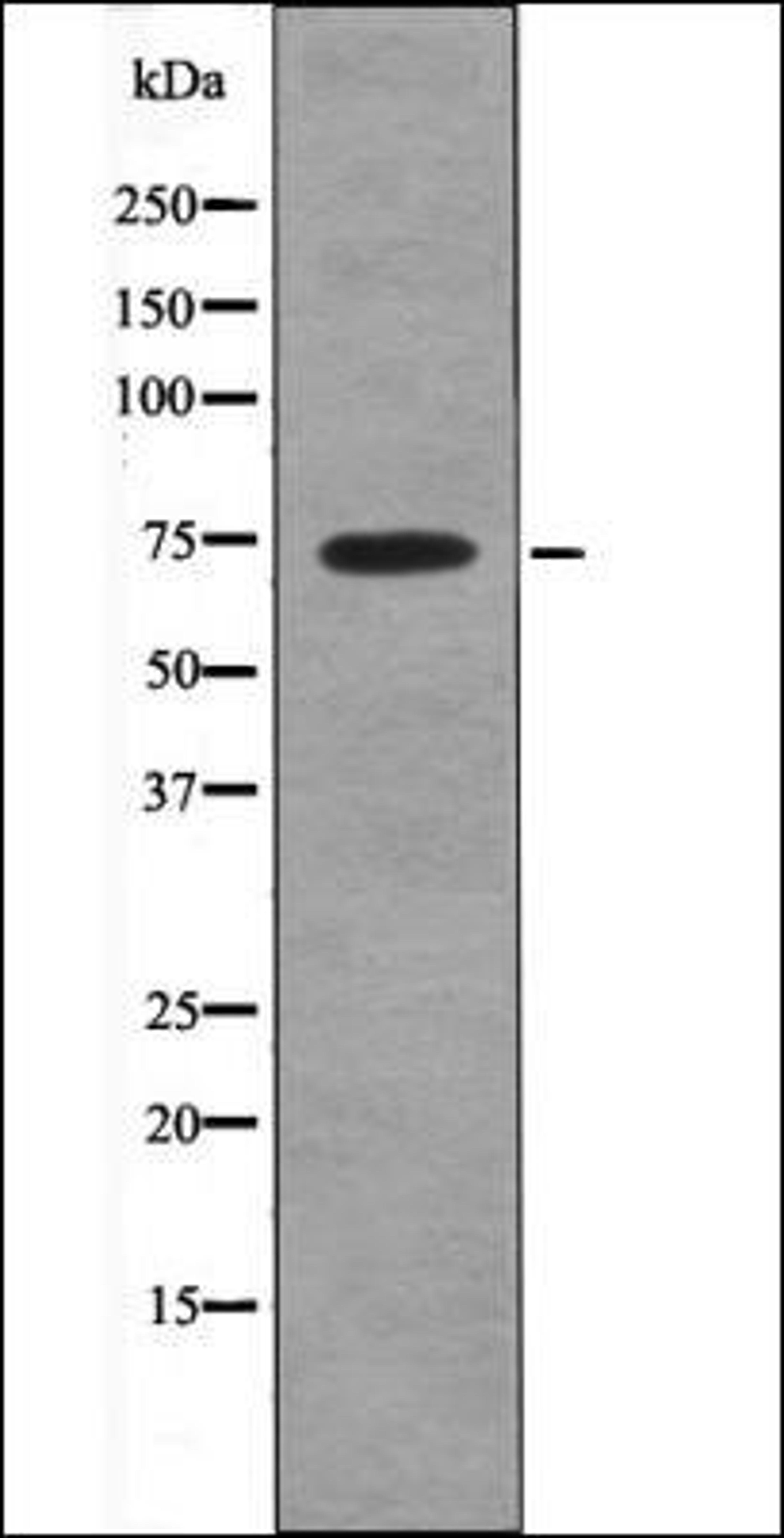 Western blot analysis of Na3VO4 treated HepG2 whole cell lysates using MAP3K2 -Phospho-Ser520- antibody