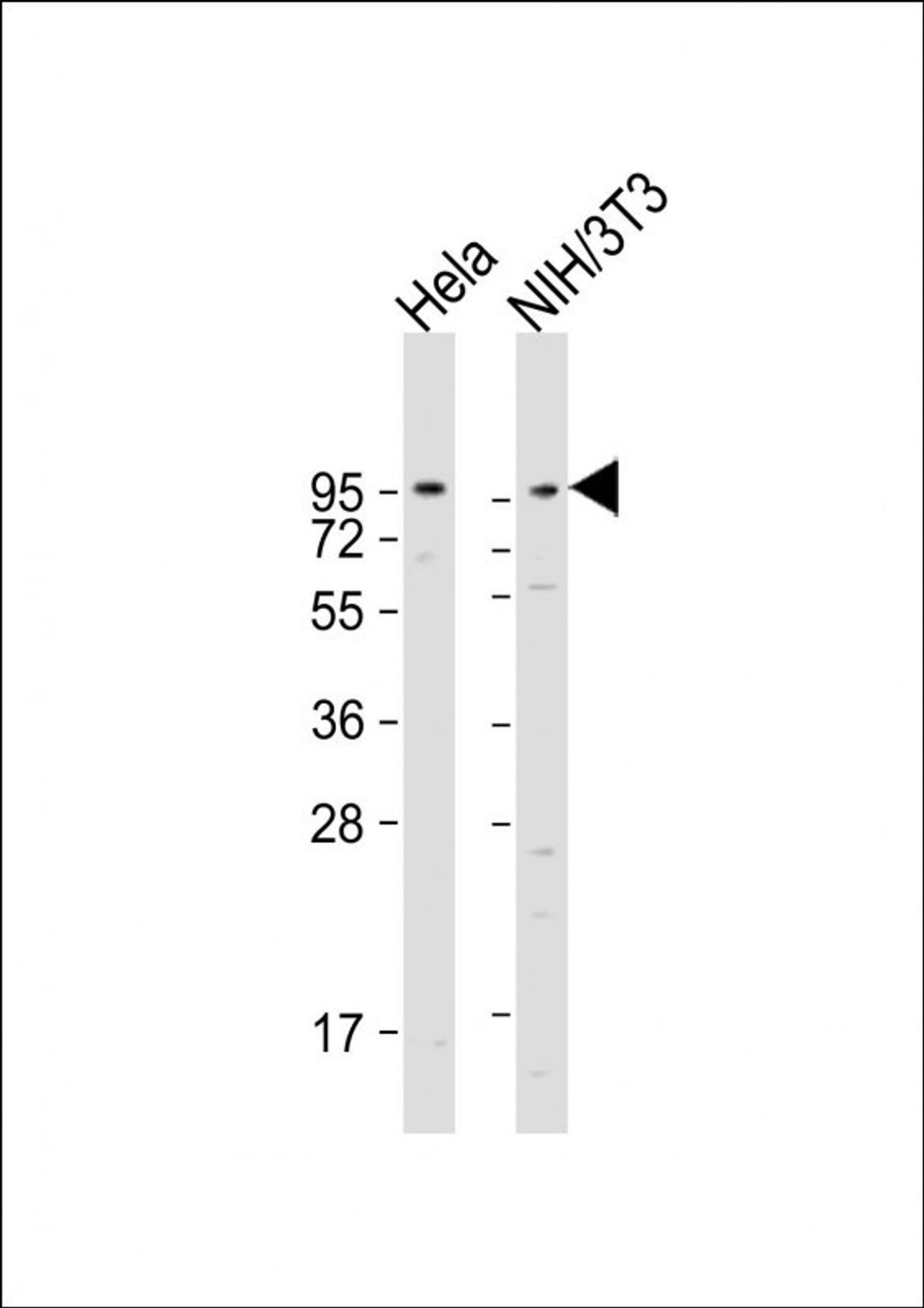 Western Blot at 1:1000-1:2000 dilution Lane 1: Hela whole cell lysate Lane 2: NIH/3T3 whole cell lysate Lysates/proteins at 20 ug per lane.