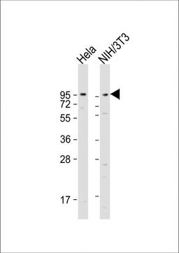 Western Blot at 1:1000-1:2000 dilution Lane 1: Hela whole cell lysate Lane 2: NIH/3T3 whole cell lysate Lysates/proteins at 20 ug per lane.