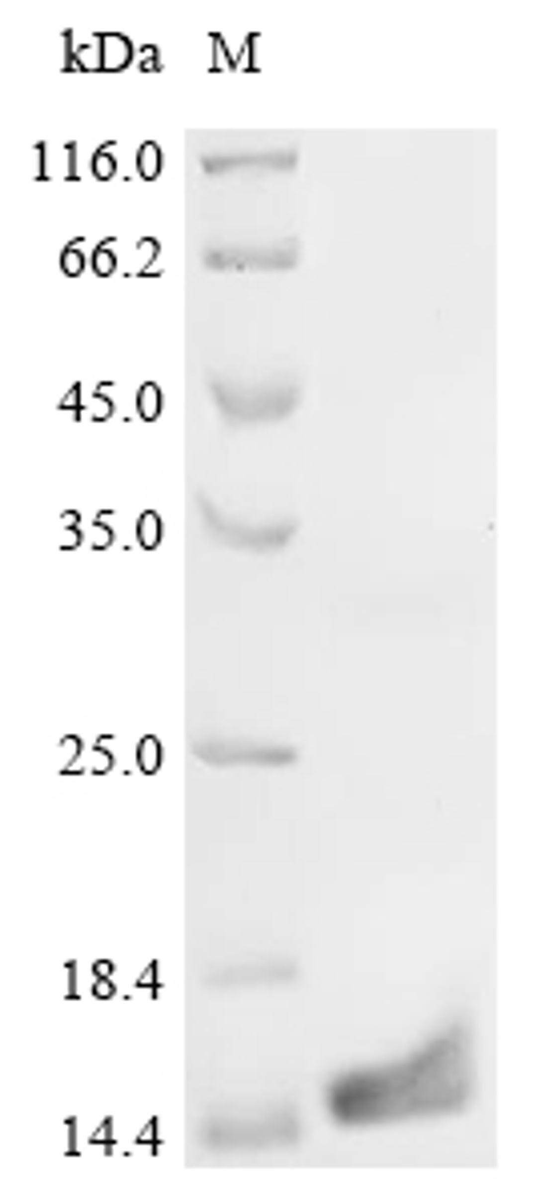 (Tris-Glycine gel) Discontinuous SDS-PAGE (reduced) with 5% enrichment gel and 15% separation gel.