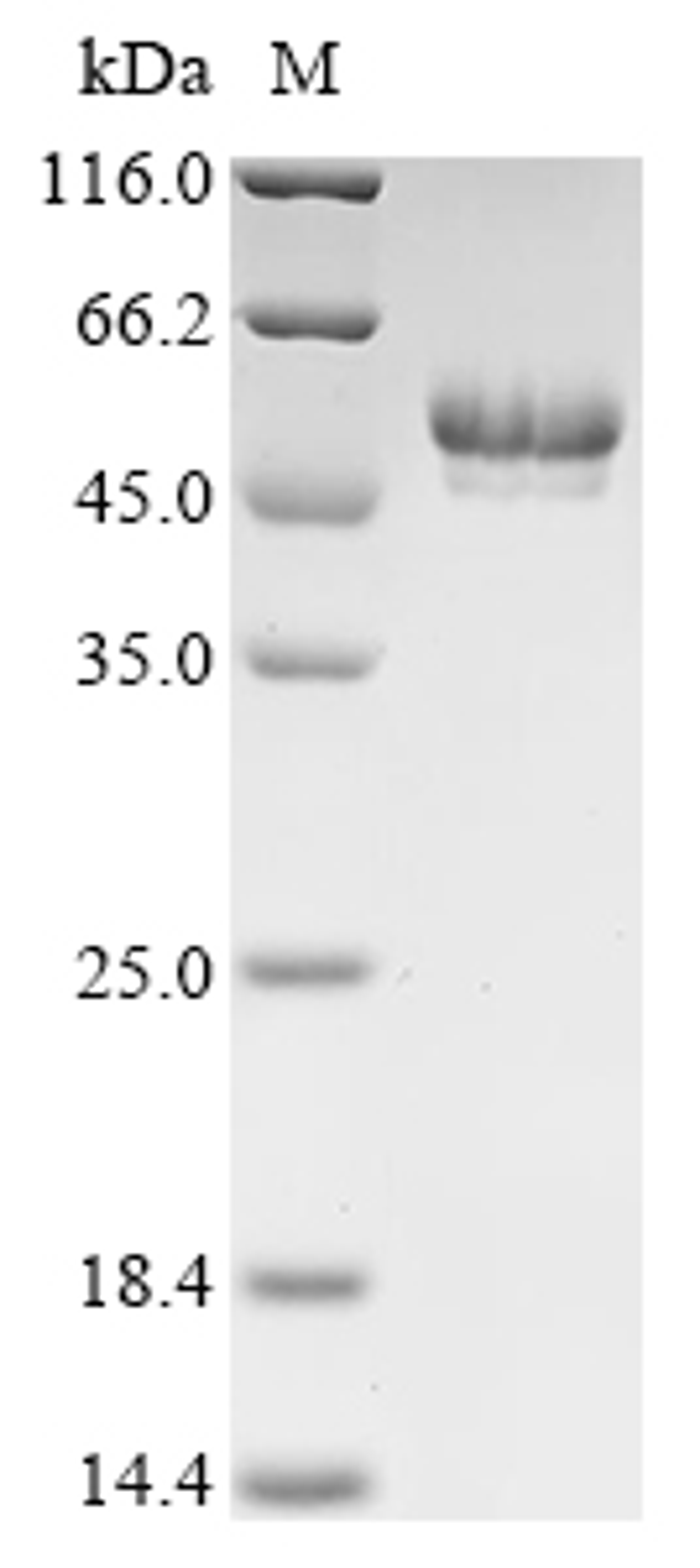 (Tris-Glycine gel) Discontinuous SDS-PAGE (reduced) with 5% enrichment gel and 15% separation gel.