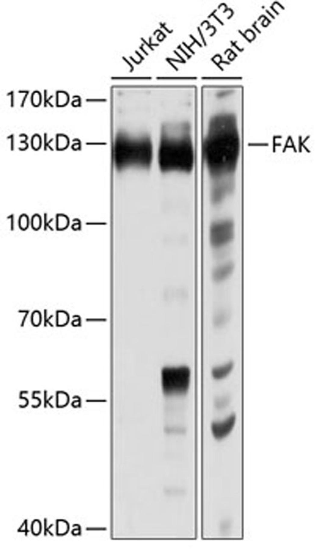 Western blot - FAK antibody (A0024)