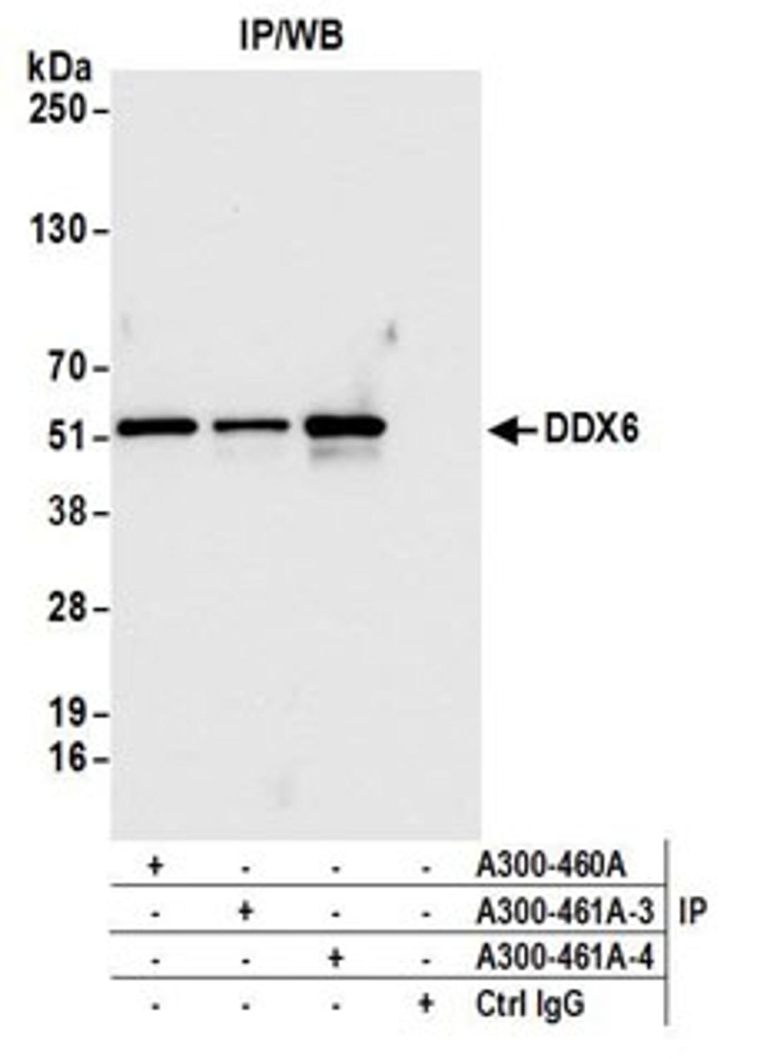 Detection of human DDX6 by western blot of immunoprecipitates.