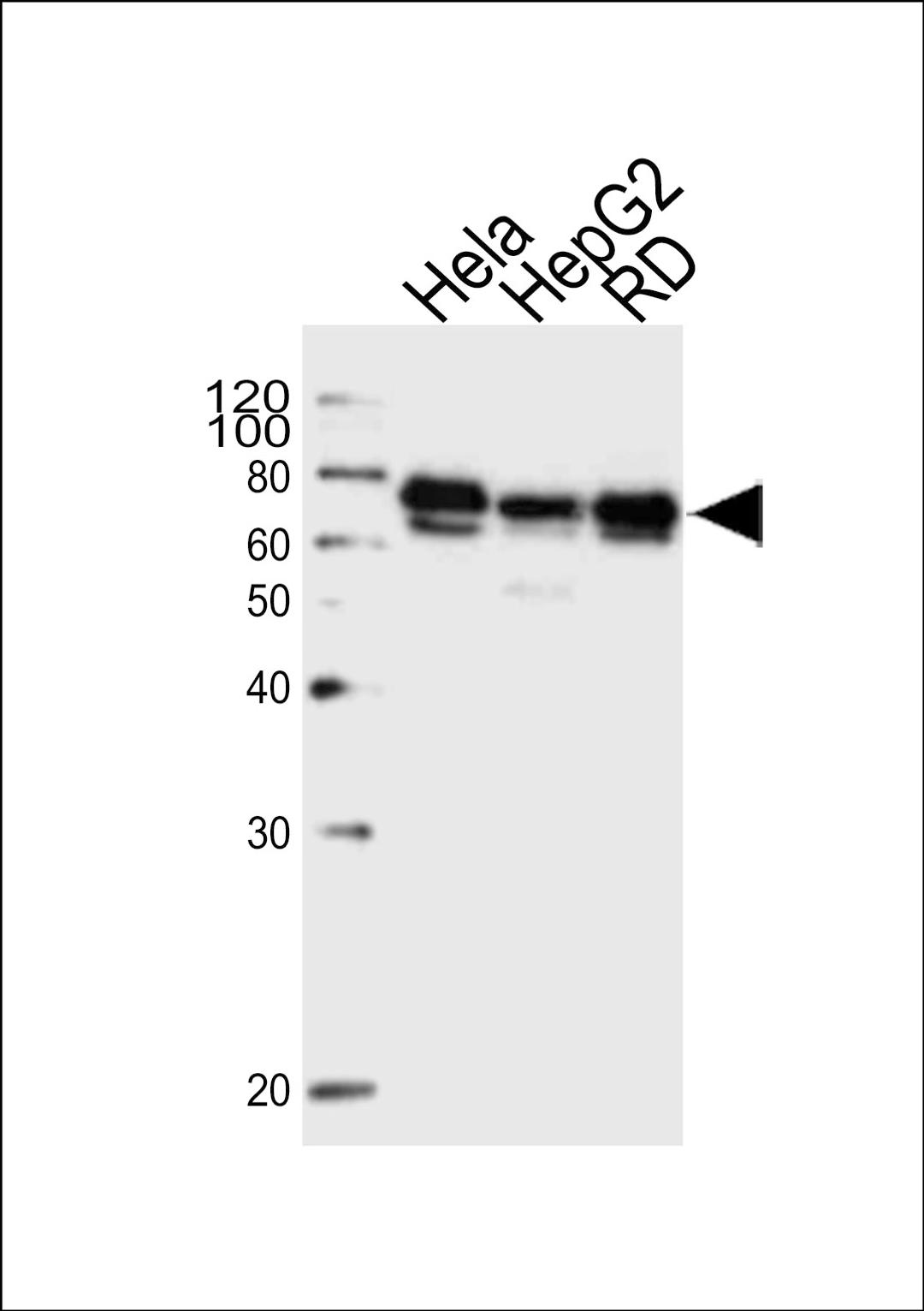 Western blot analysis of lysates from Hela, HepG2, RD cell line (from left to right), using PRKAG3 Antibody at 1:1000 at each lane.