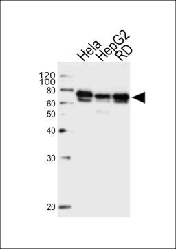 Western blot analysis of lysates from Hela, HepG2, RD cell line (from left to right), using PRKAG3 Antibody at 1:1000 at each lane.