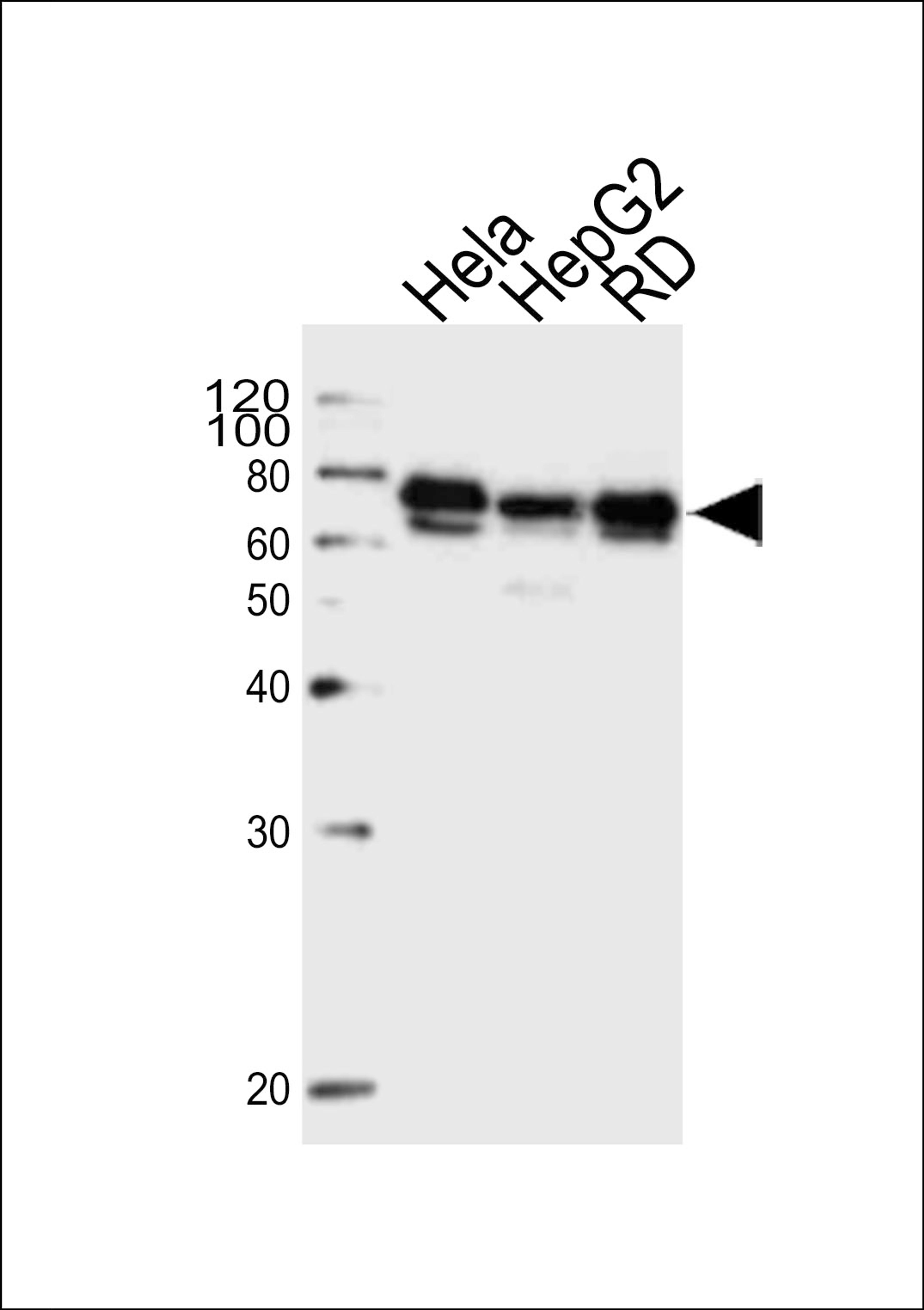 Western blot analysis of lysates from Hela, HepG2, RD cell line (from left to right), using PRKAG3 Antibody at 1:1000 at each lane.