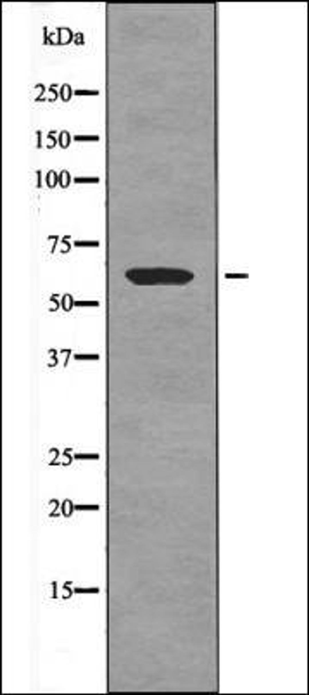 Western blot analysis of Paclitaxel treated HeLa whole cell lysates using CRMP-1 -Phospho-Tyr504- antibody