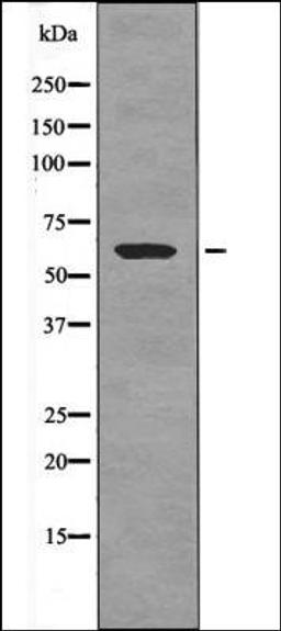 Western blot analysis of Paclitaxel treated HeLa whole cell lysates using CRMP-1 -Phospho-Tyr504- antibody