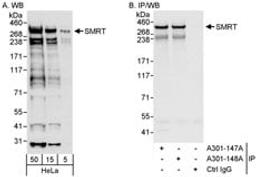 Detection of human SMRT by western blot and immunoprecipitation.