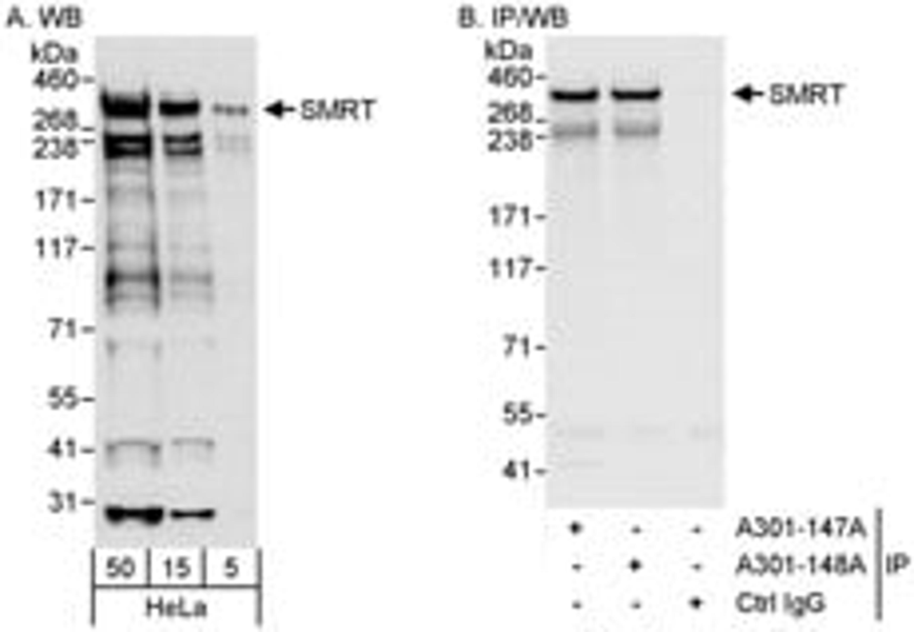 Detection of human SMRT by western blot and immunoprecipitation.