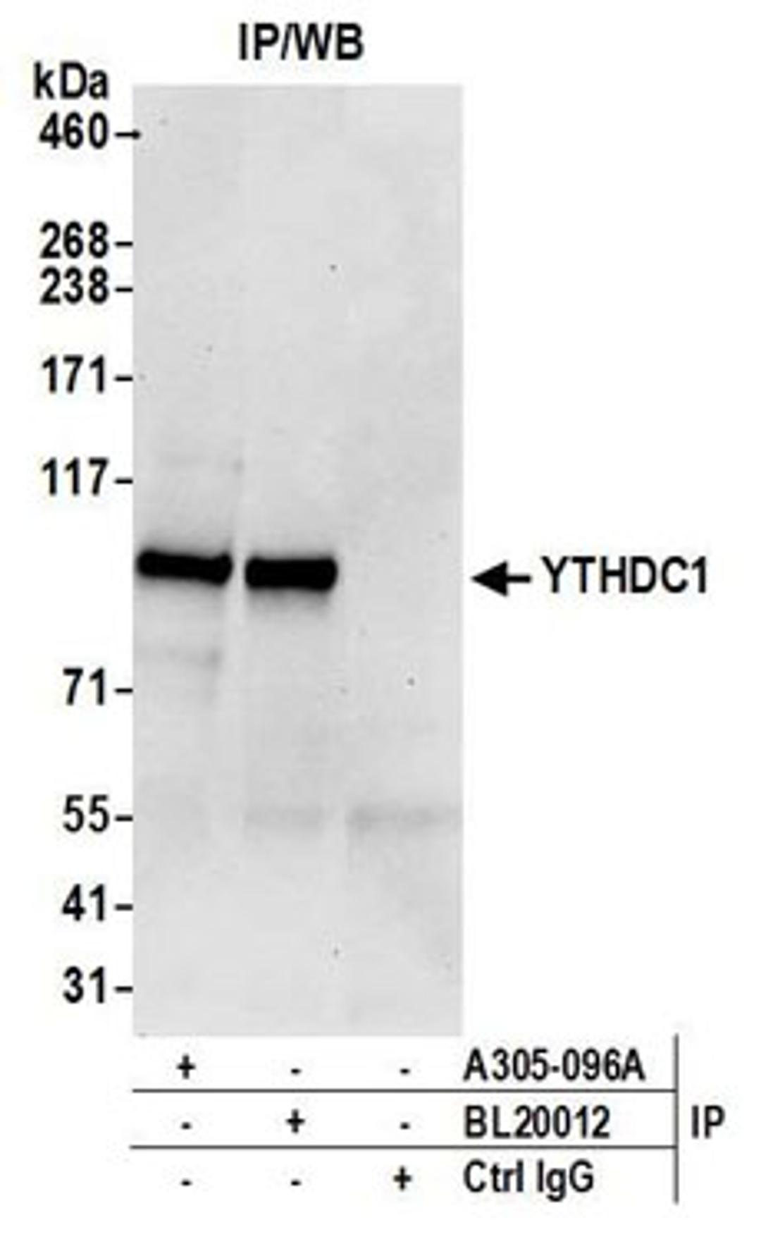 Detection of human YTHDC1 by western blot of immunoprecipitates.