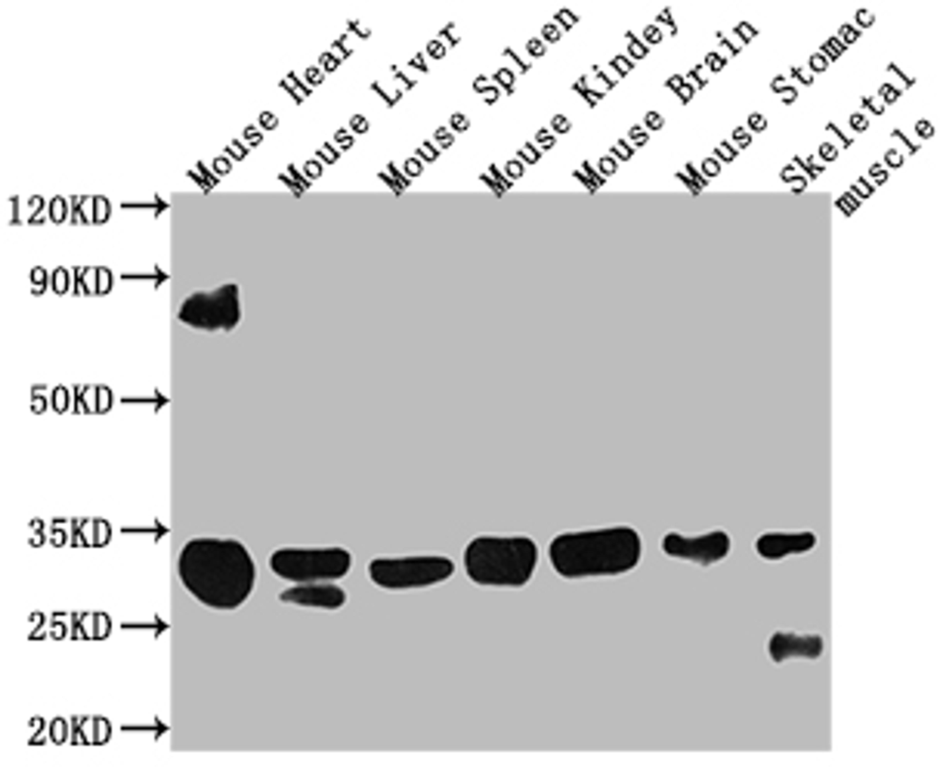 Western Blot. Positive WB detected in: Mouse heart tissue, Mouse Liver tissue, Mouse Spleen tissue, Mouse Kidney tissue, Mouse brain tissue, Mouse stomach tissue, Mouse skeletal muscle tissue. All lanes: Fgf15 antibody at 1:2000. Secondary. Goat polyclonal to rabbit IgG at 1/50000 dilution. Predicted band size: 26 kDa. Observed band size: 30 kDa. 