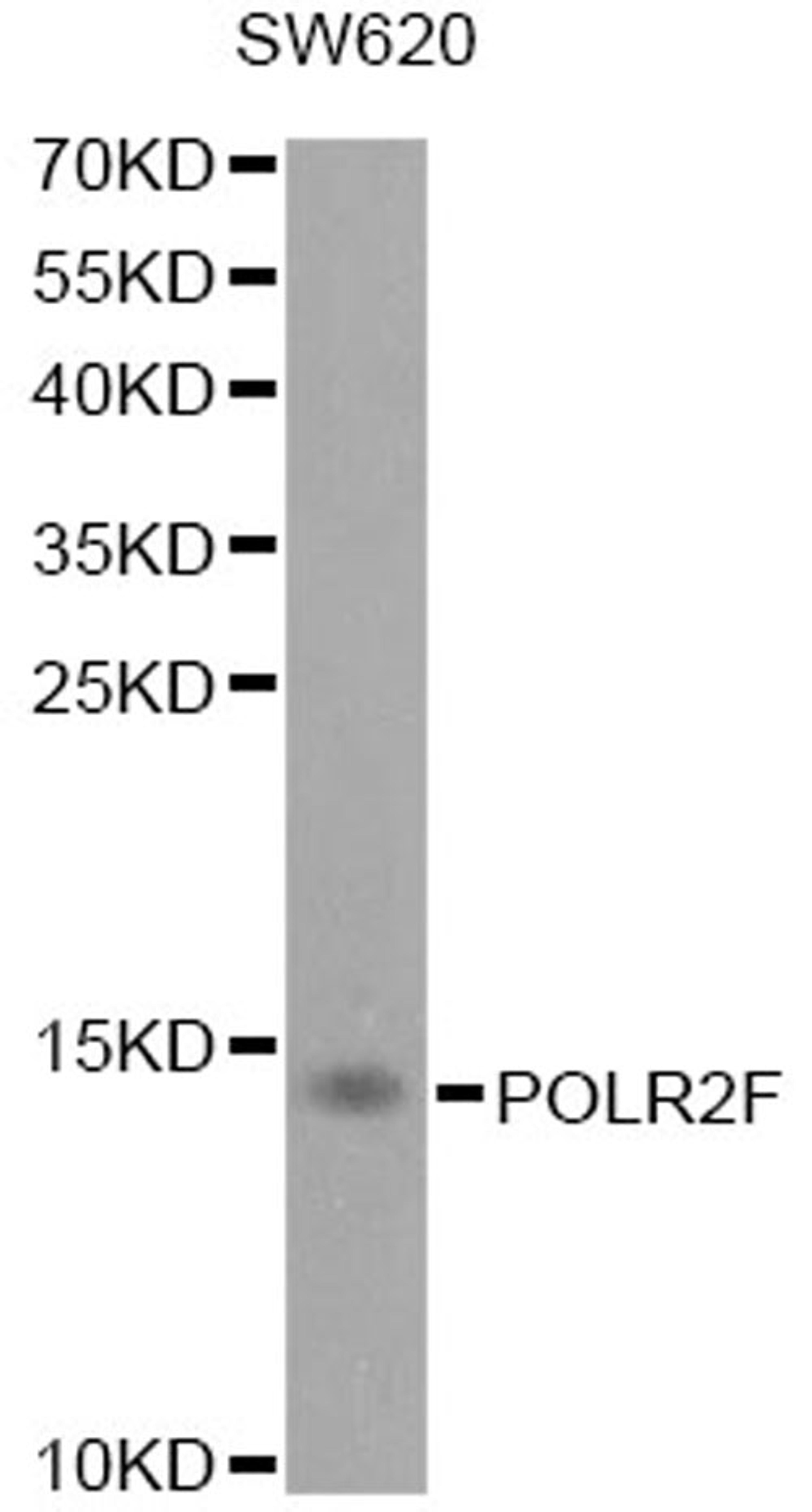 Western blot - POLR2F antibody (A1824)