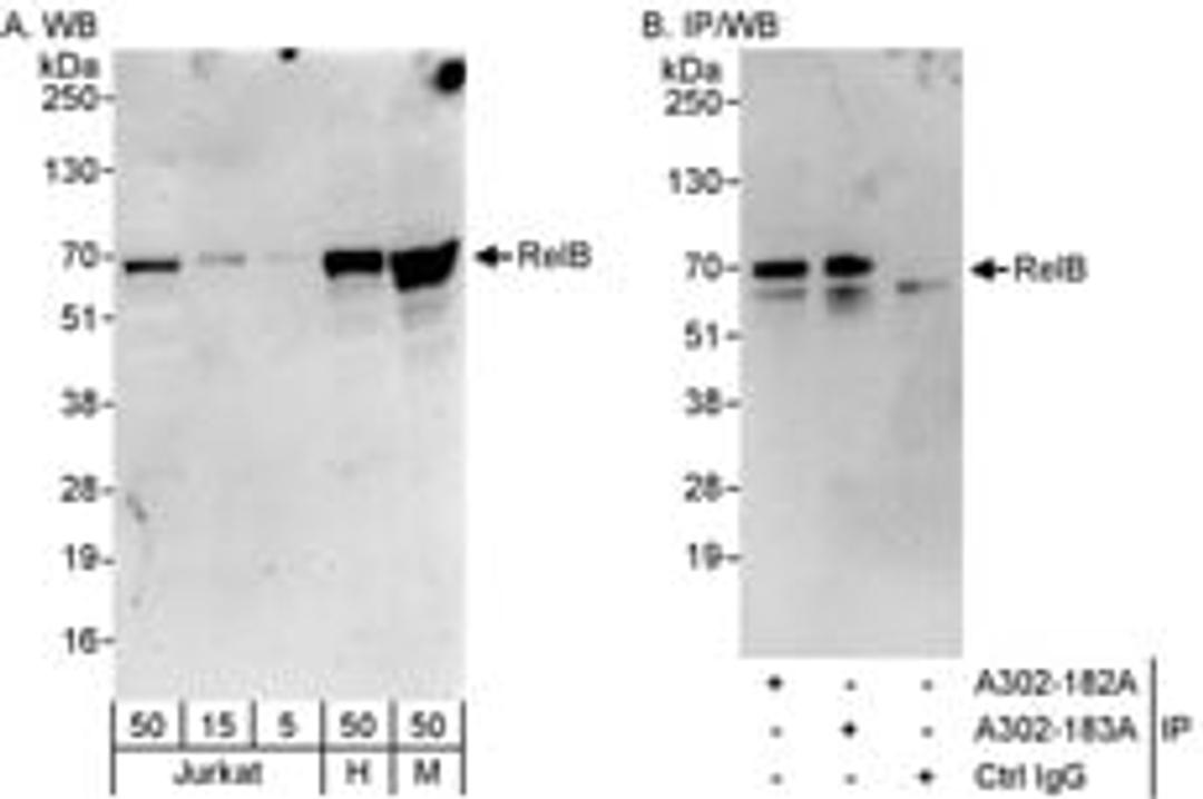 Detection of human and mouse RelB by western blot (h&m) and immunoprecipitation (h).