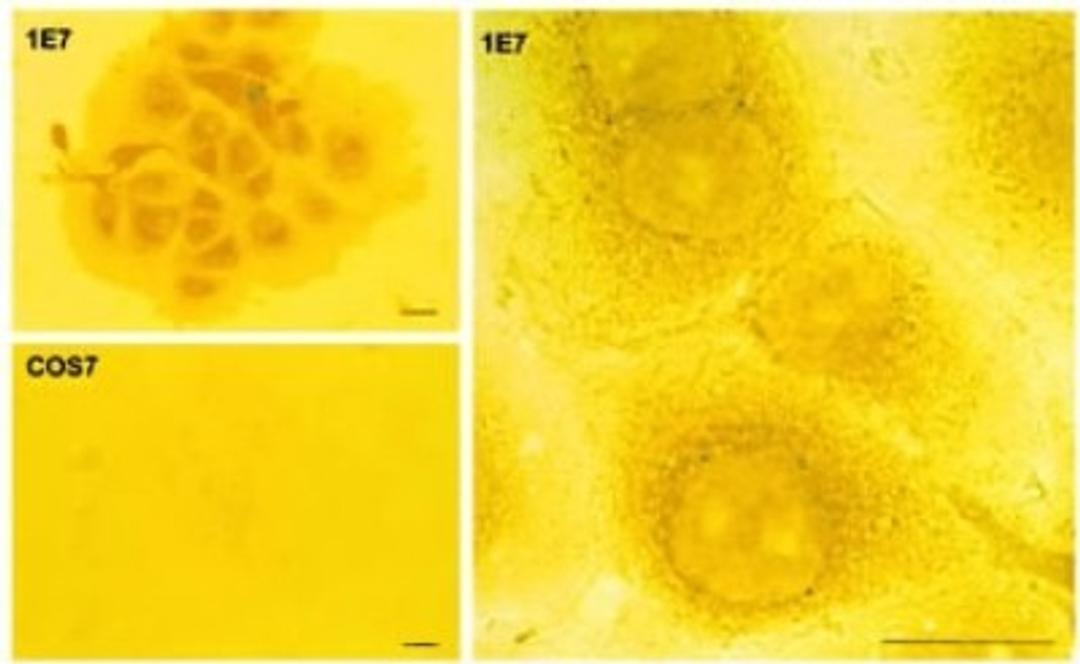 Immunocytochemistry/Immunofluorescence: Serotonin N-acetyltransferase Antibody [NB100-135] - AANAT in COS7 and 1E7 cells detected by ICC. Cells were grown on two-well chamber slides and fixed with 2.5% glutaraldehyde; 1E7 cells treated with FSK for 3 h (two magnifications). COS, COS7 cells treated with FSK for 3 h.