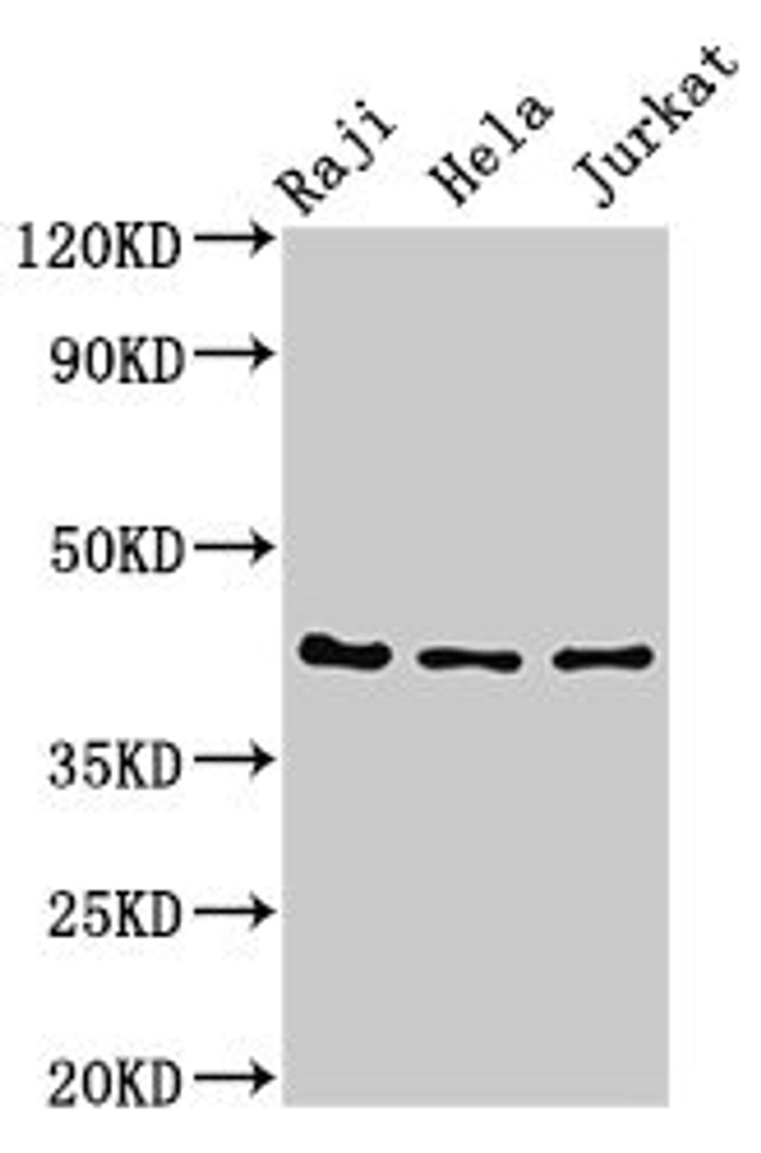 Western Blot. Positive WB detected in: Raji whole cell lysate, Hela whole cell lysate, Jurkat whole cell lysate. All lanes: Pregnancy-associated glycoprotein 1 antibody at 3ug/ml. Secondary. Goat polyclonal to rabbit IgG at 1/50000 dilution. Predicted band size: 43 kDa. Observed band size: 43 kDa. 