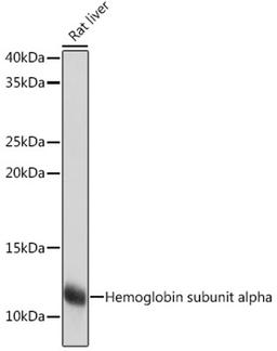 Western blot - Hemoglobin subunit alpha Rabbit mAb (A9293)